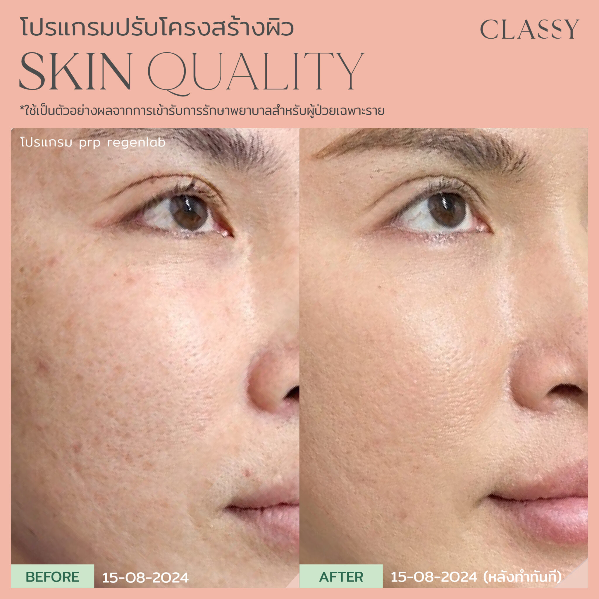 BA SKIN QUALITY-17