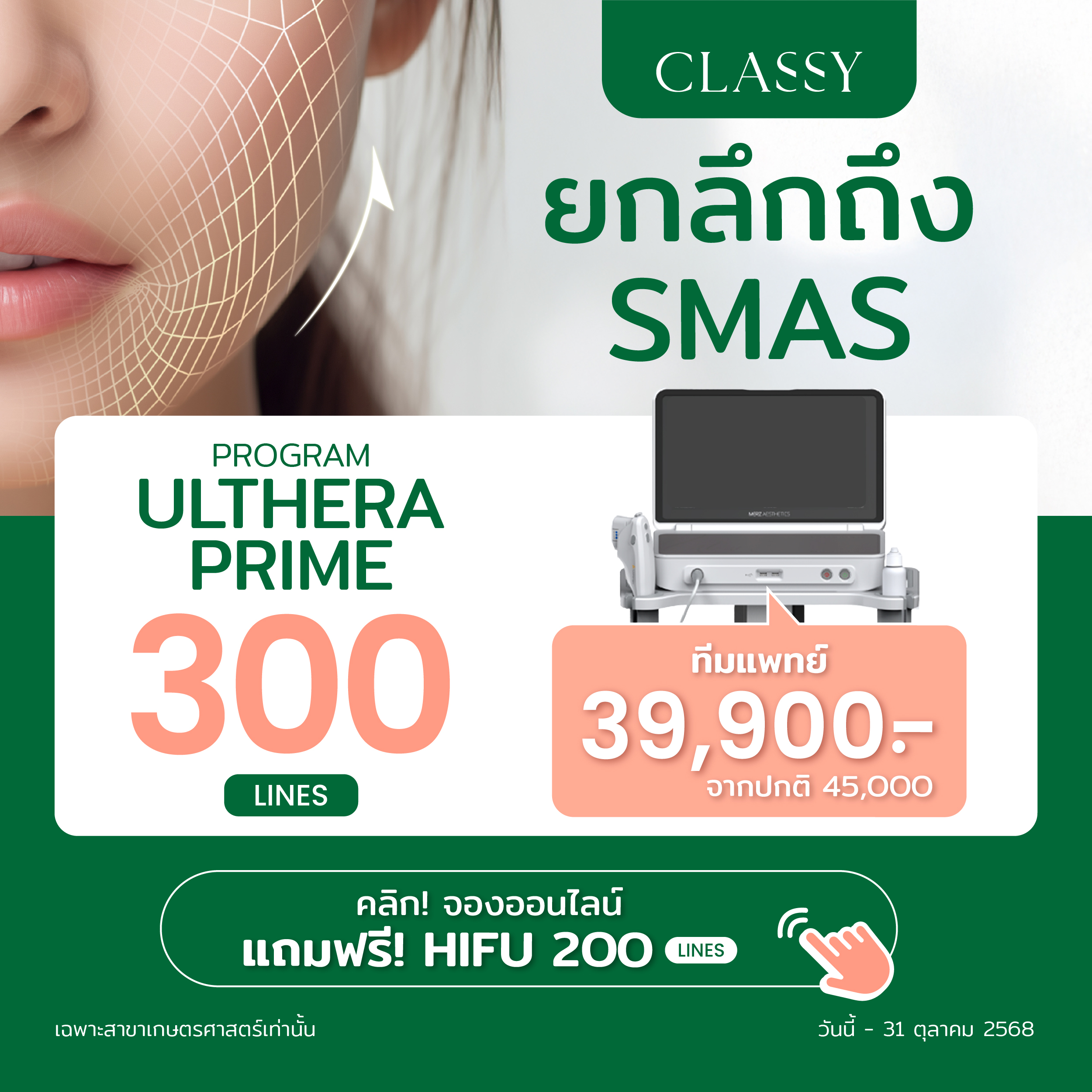 Line Card-02