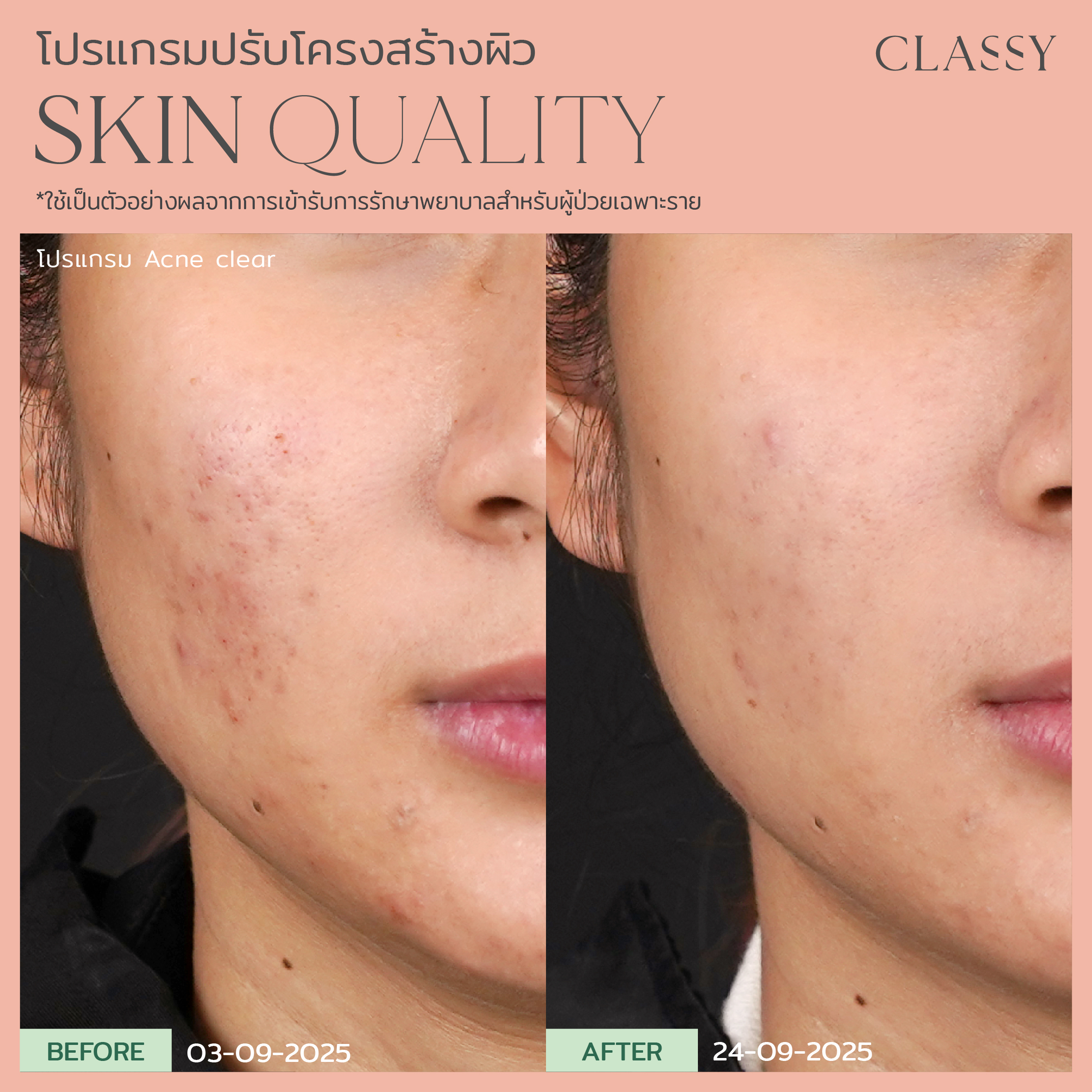 BA SKIN QUALITY-03