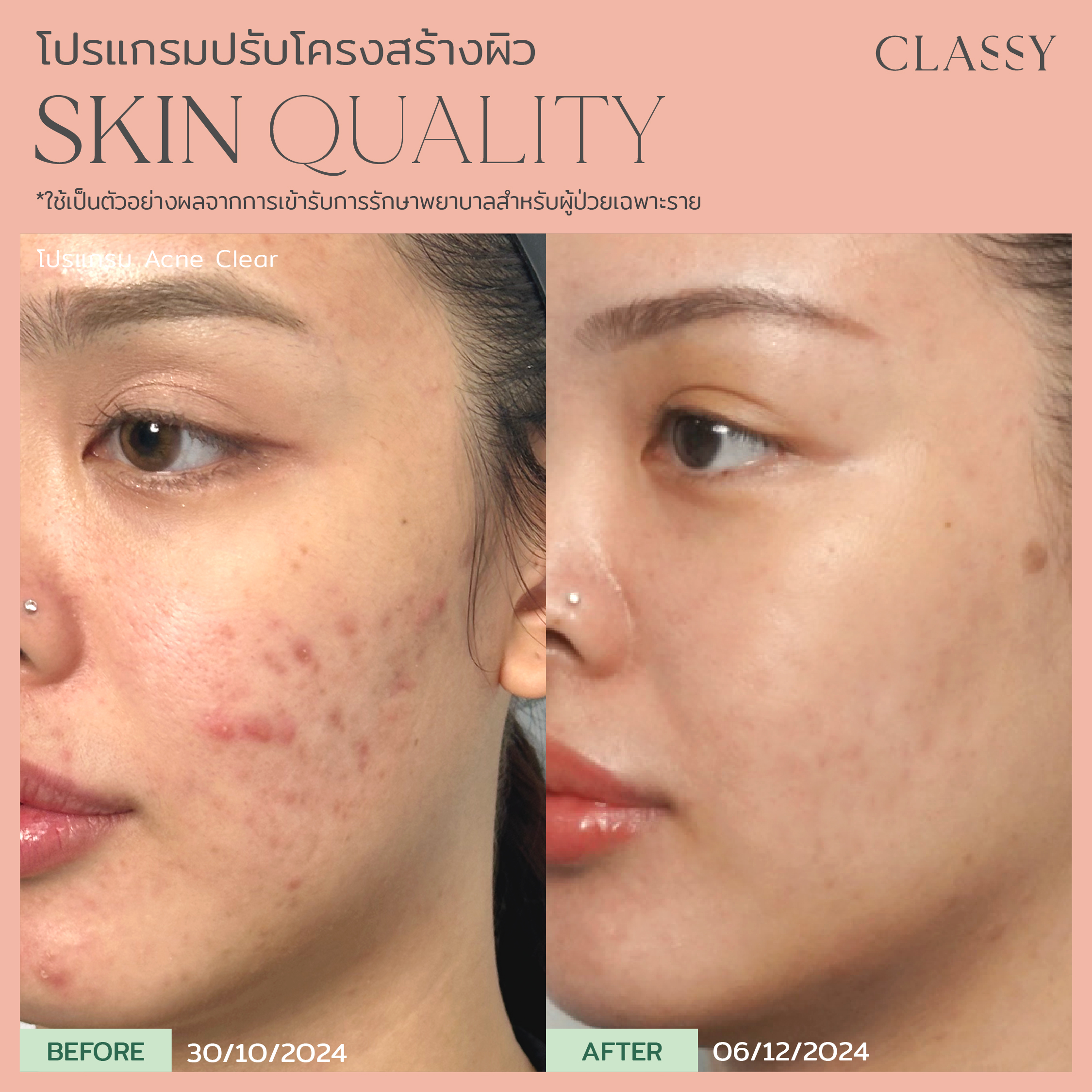 BA SKIN QUALITY-03