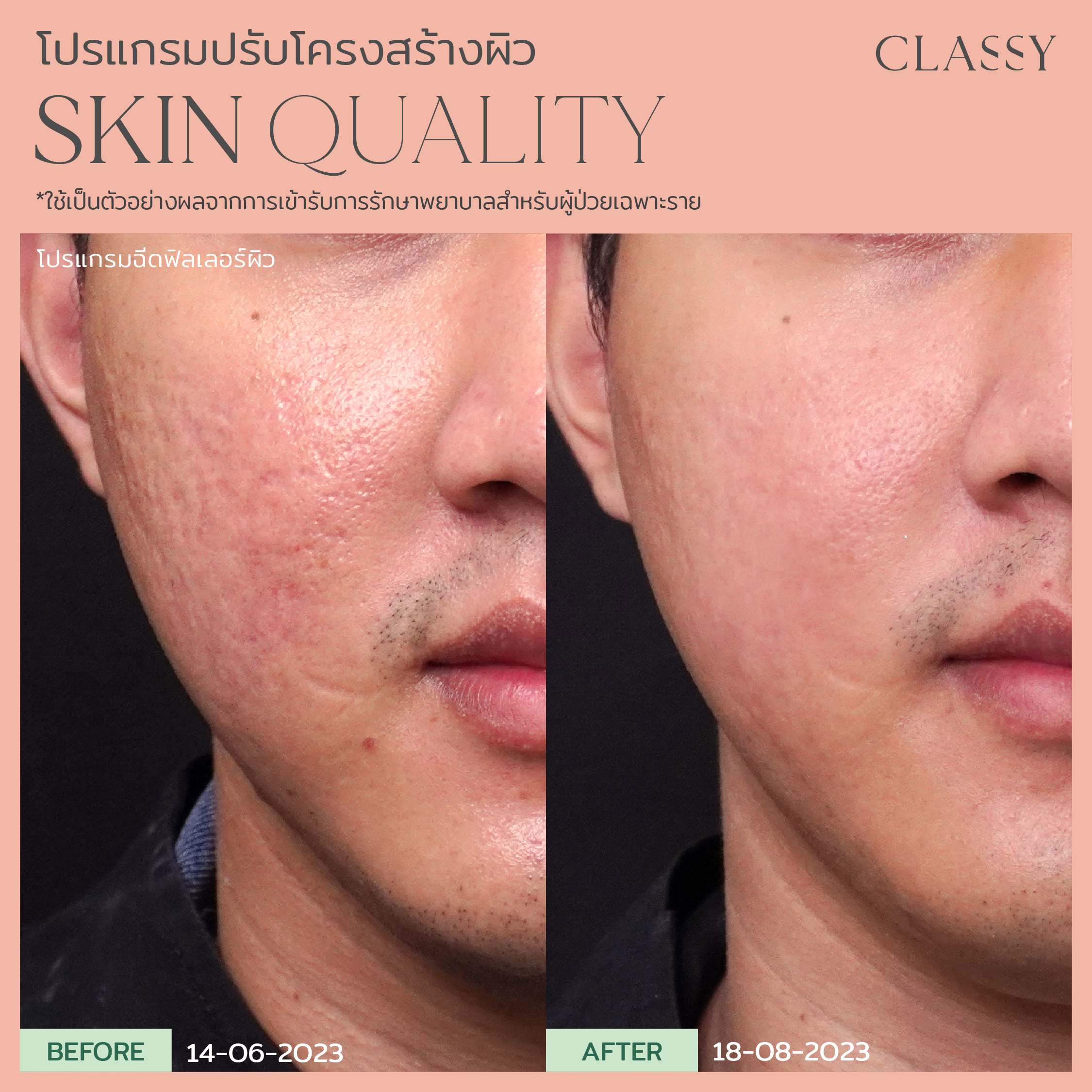 BA SKIN QUALITY-13