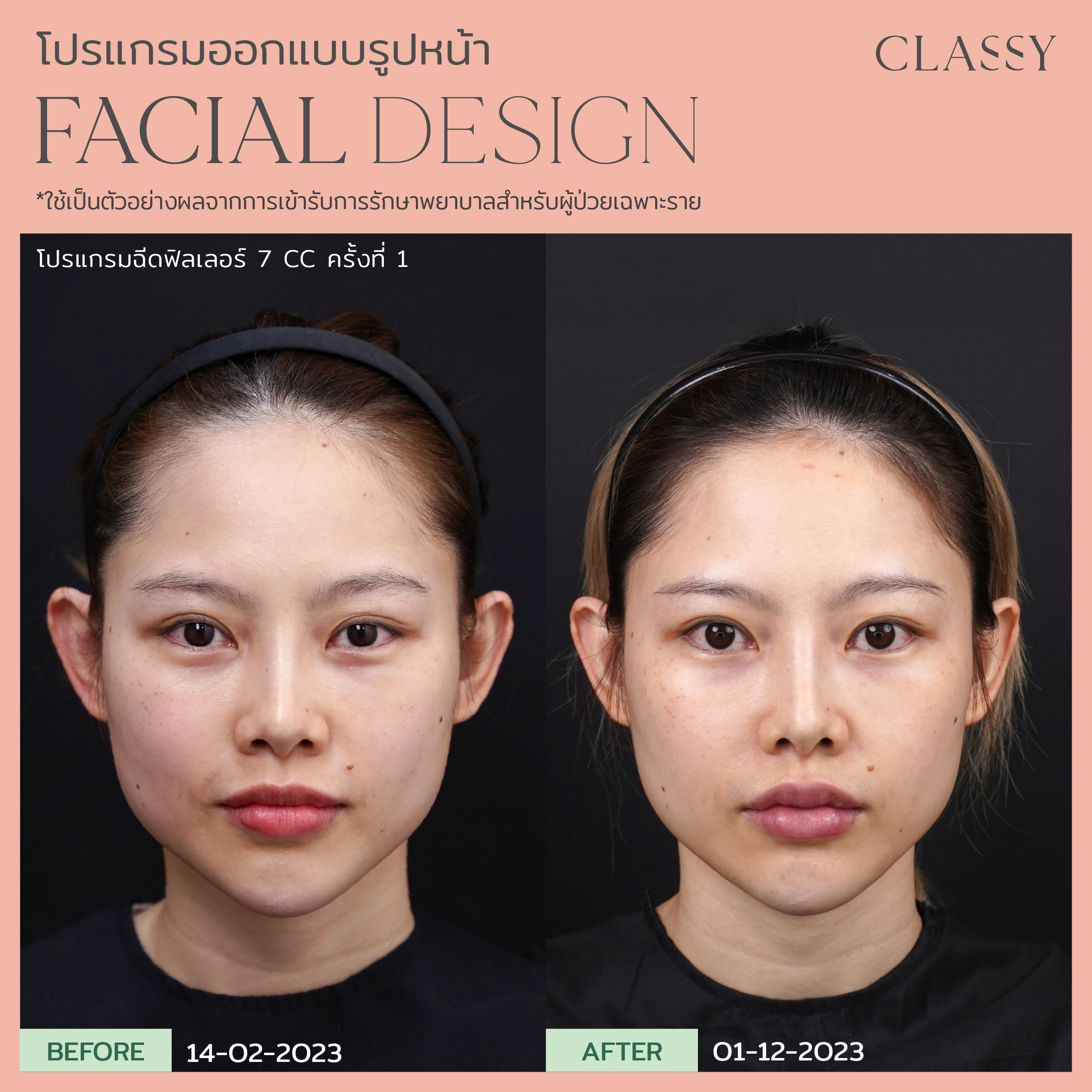BA FACIAL DESIGN-06