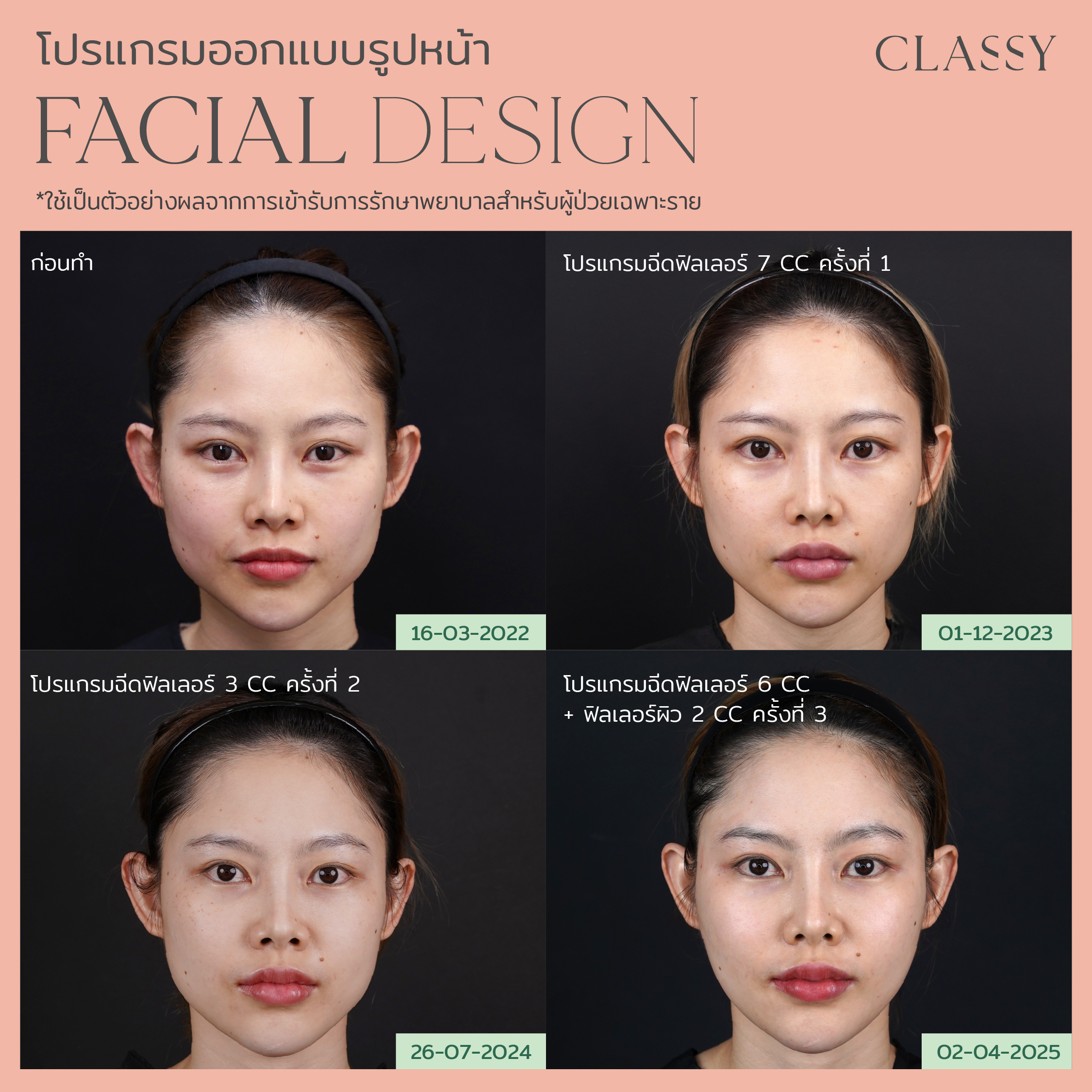 BA FACIAL DESIGN-17