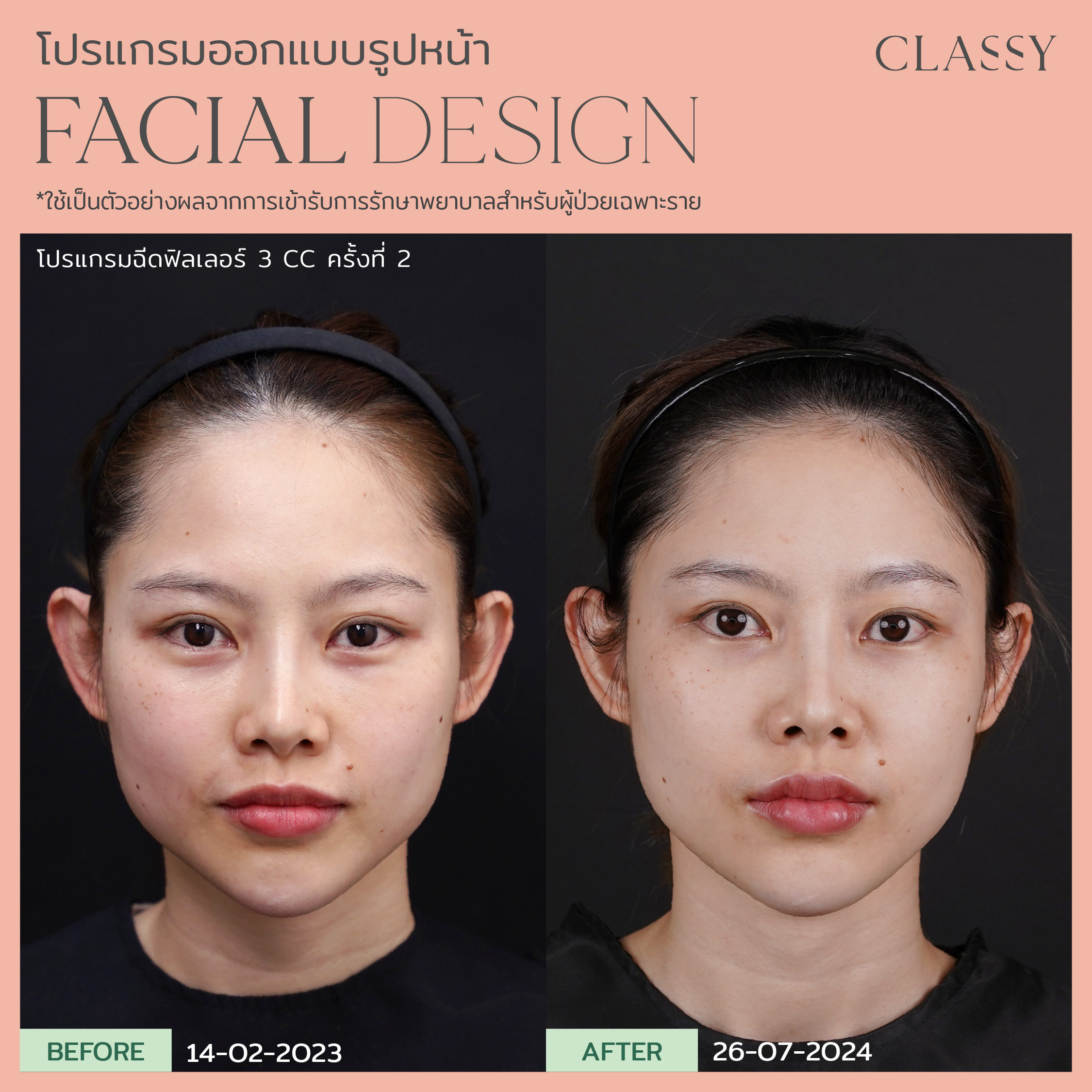 BA FACIAL DESIGN-18