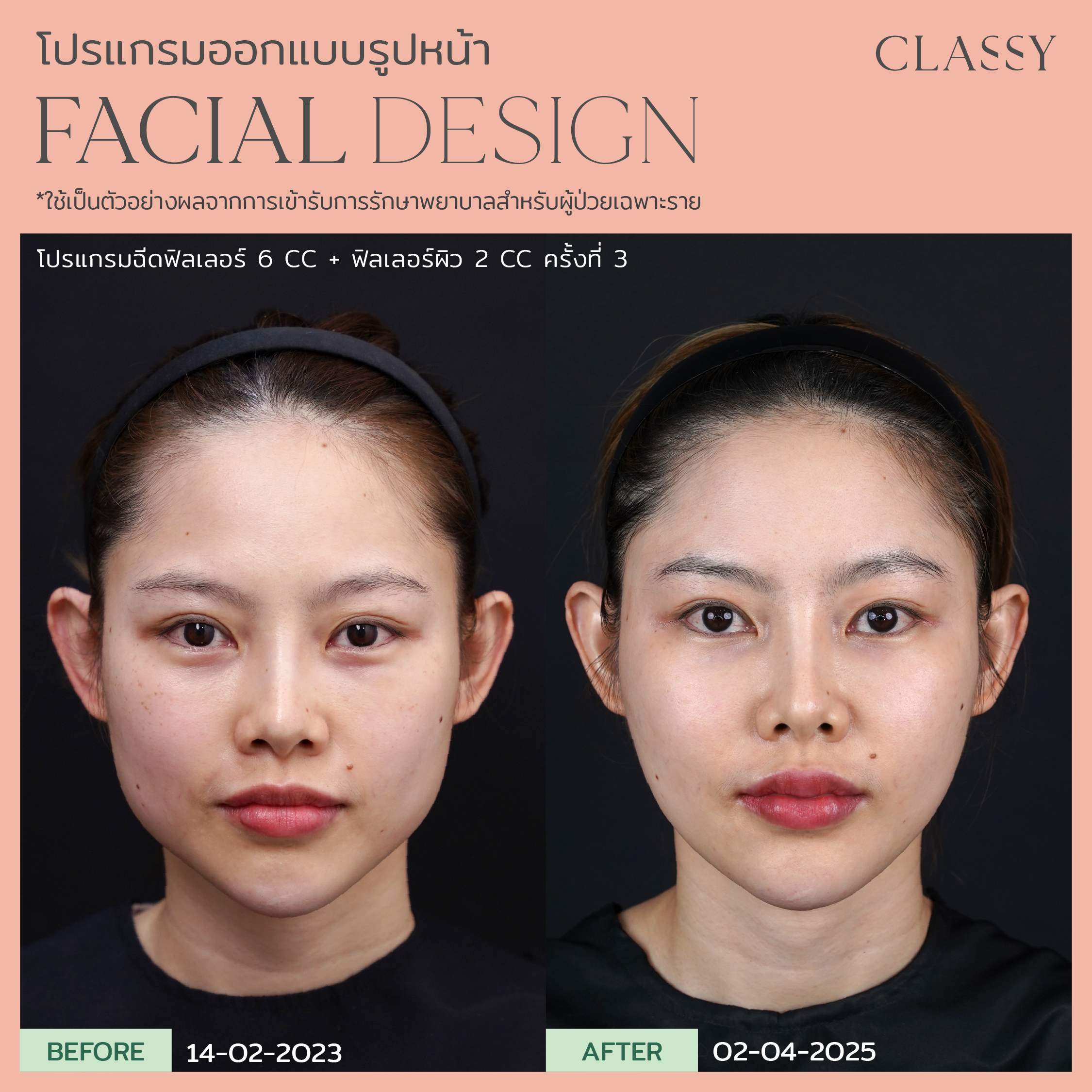 BA FACIAL DESIGN-19