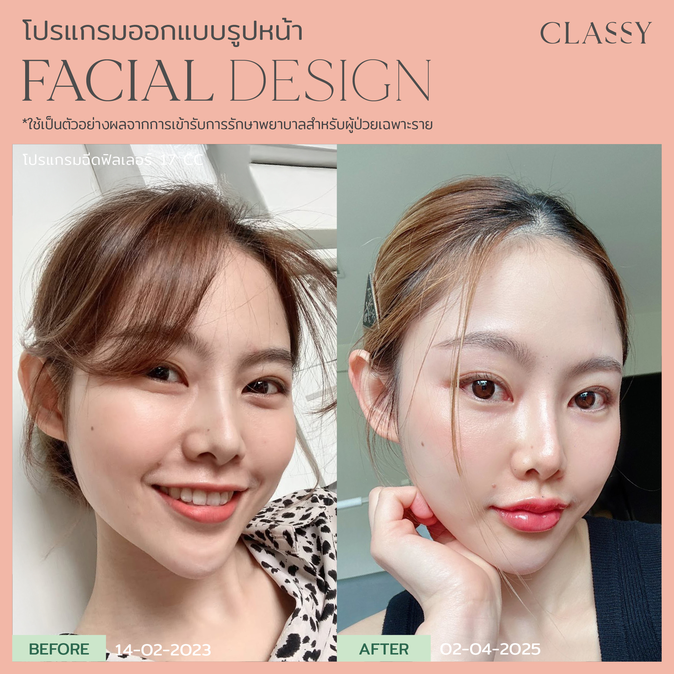 BA FACIAL DESIGN-21