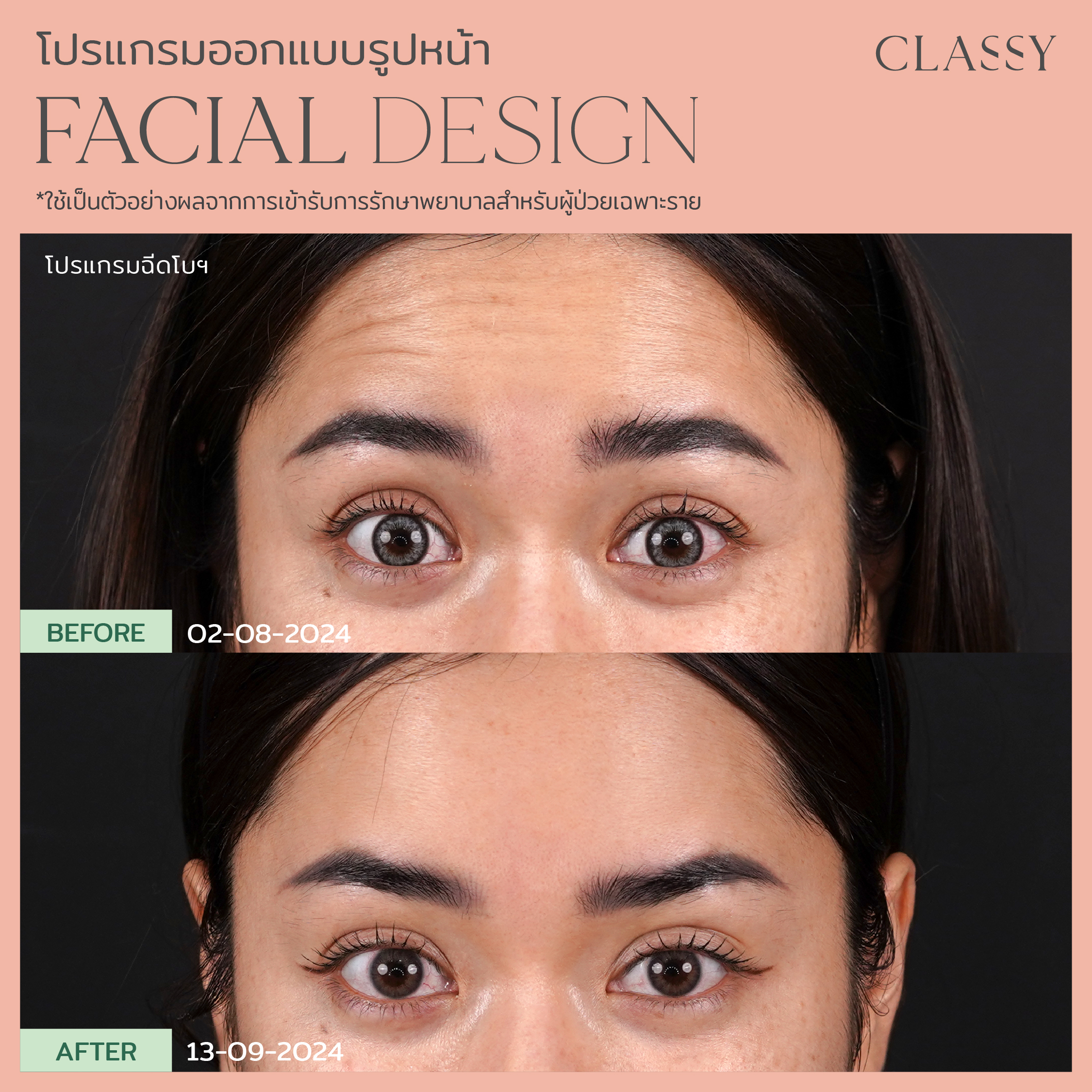 BA FACIAL DESIGNเมเด -17