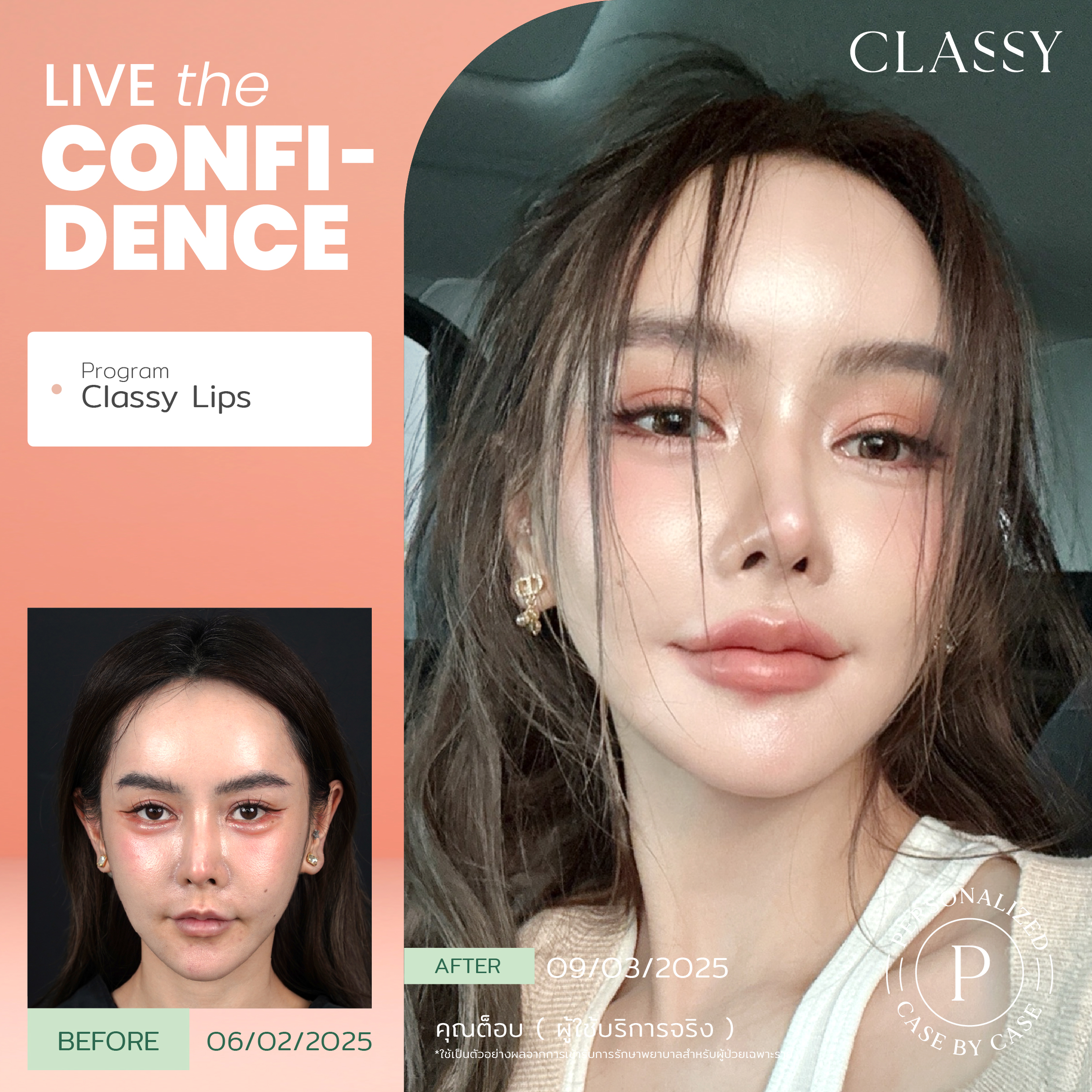 unbox - yourconfidence 24 BA live for confi set 5 -04