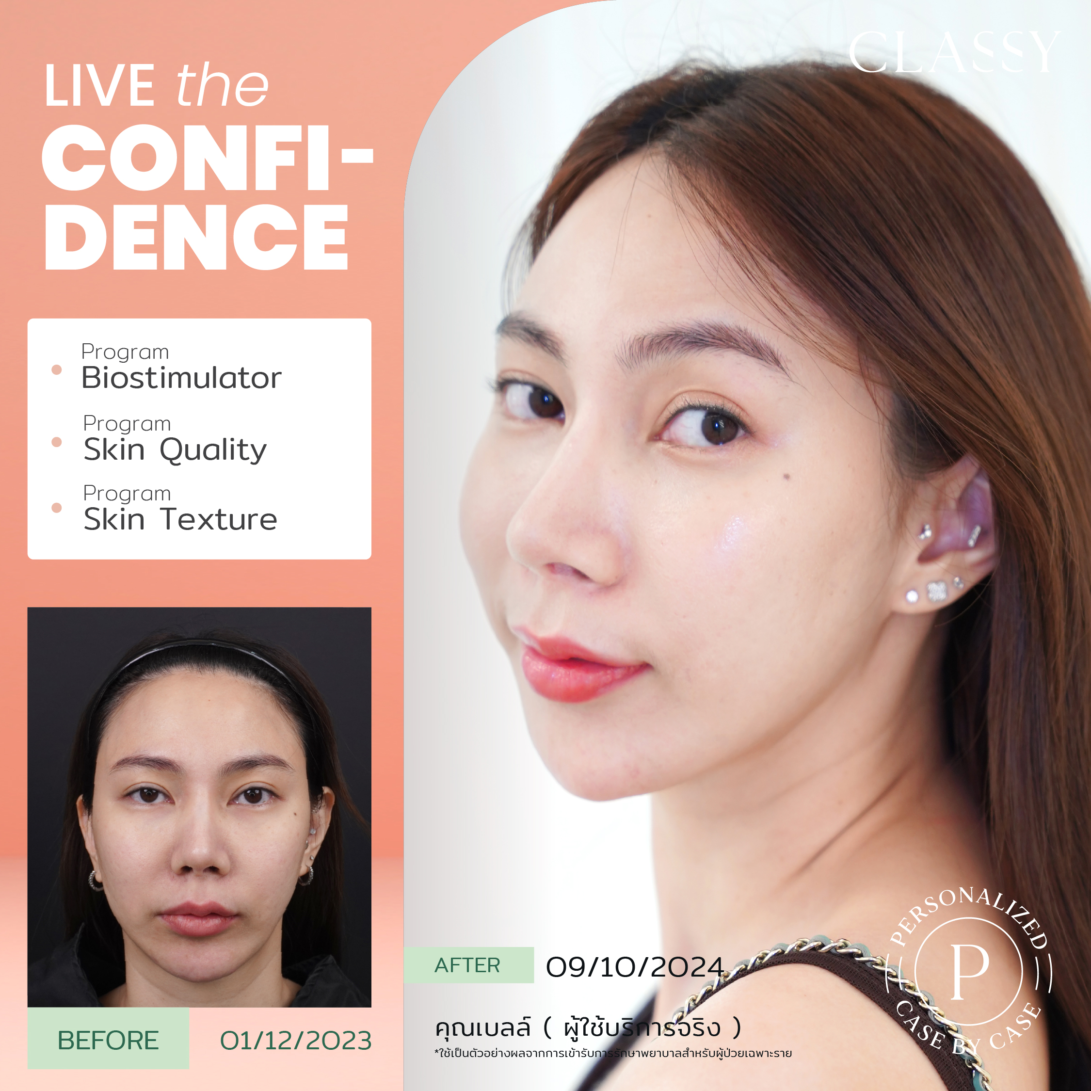 unbox - yourconfidence 65 BA live for confi set 5 -05