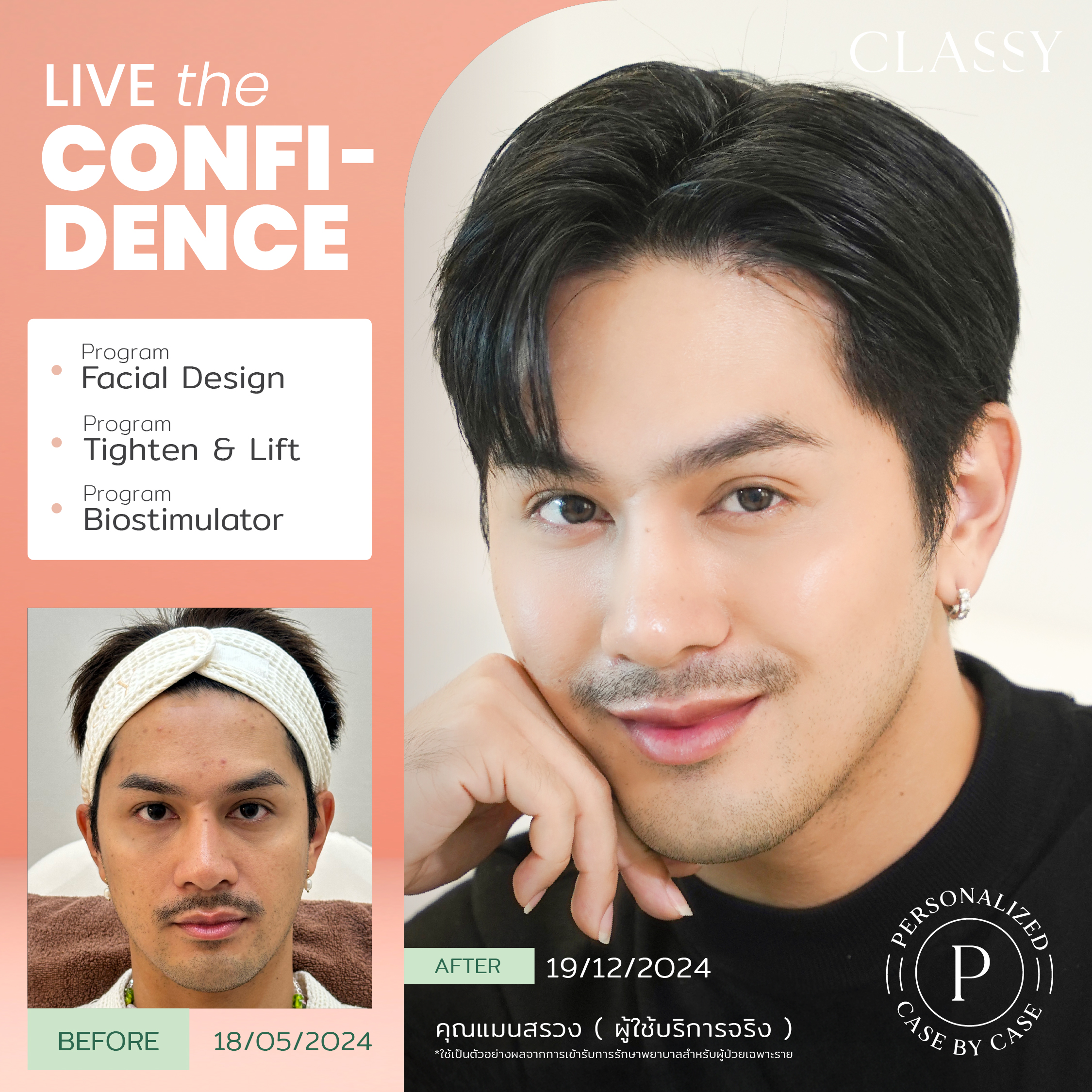 unbox - yourconfidence 66 BA live for confi set 5 -06