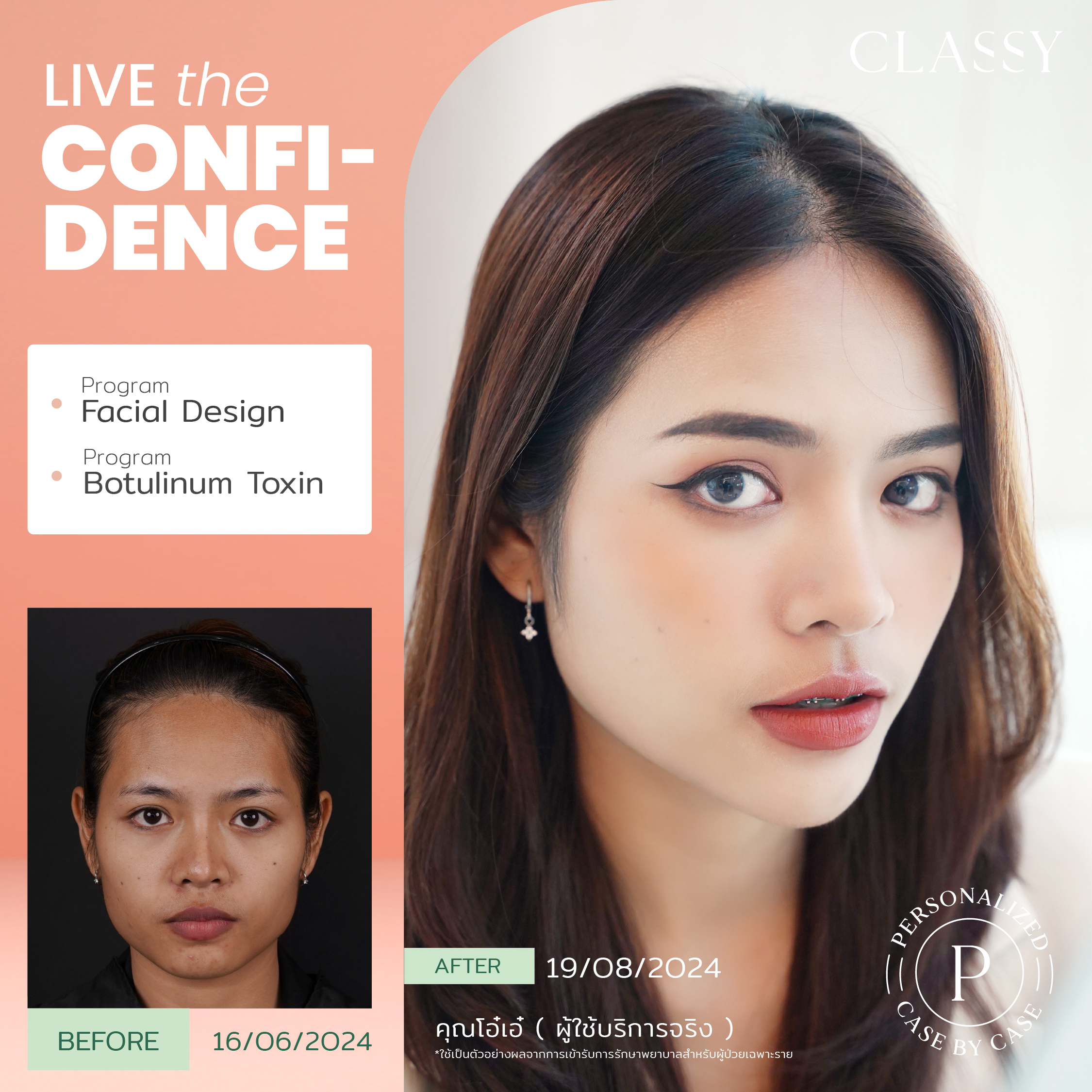 unbox - yourconfidence 10 BA live for confi set 5 -07