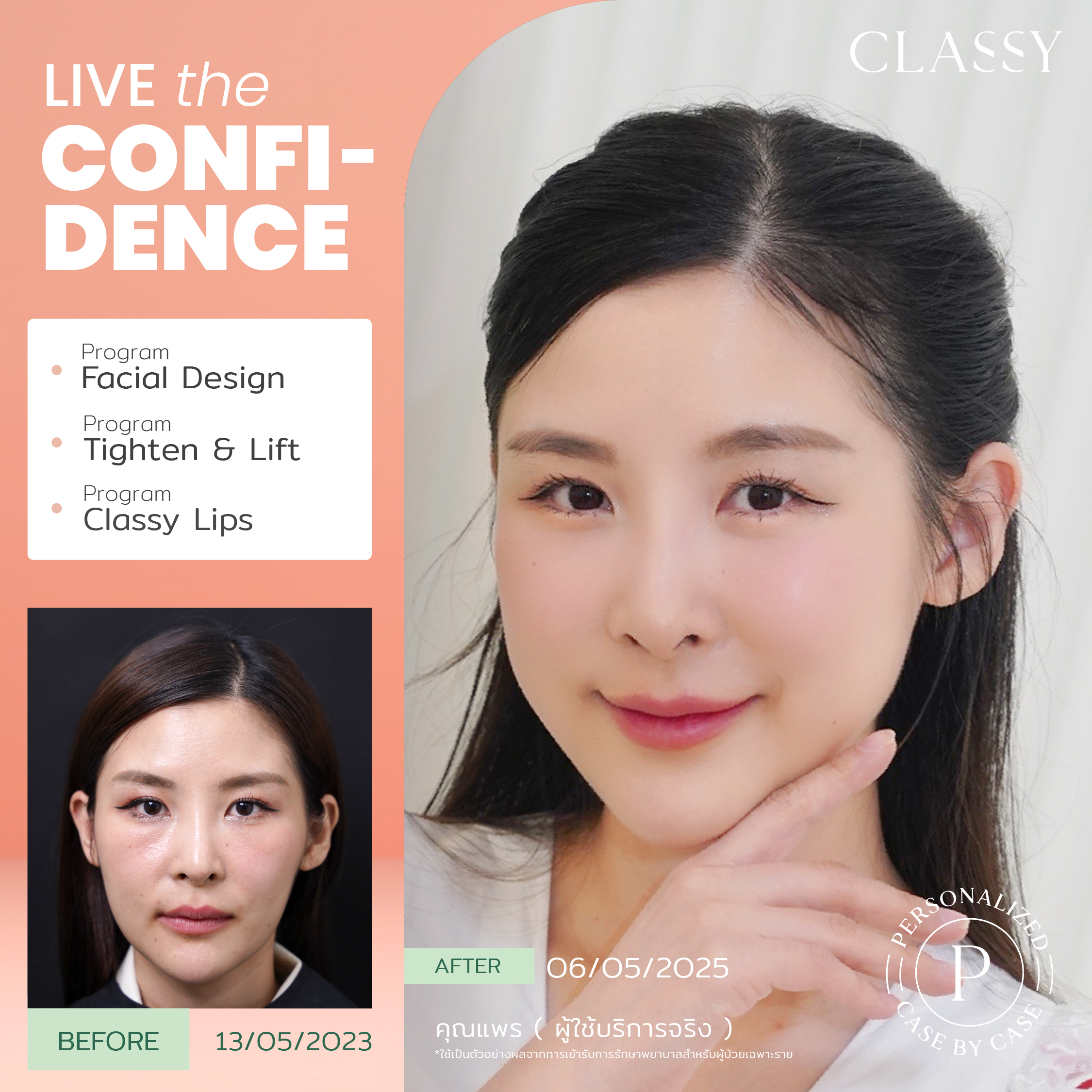 unbox - yourconfidence 42 BA live for confi set 6_Artboard 1 copy 11