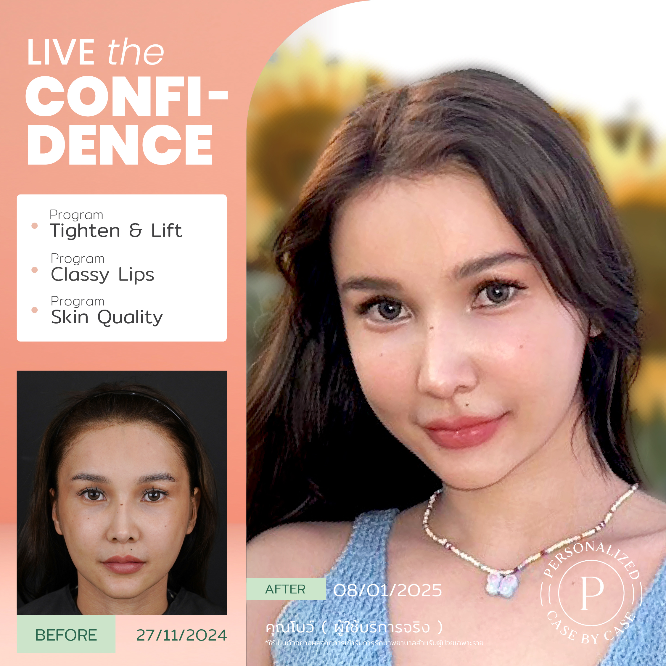 unbox - yourconfidence 41 BA live for confi set 6_Artboard 1 copy 12