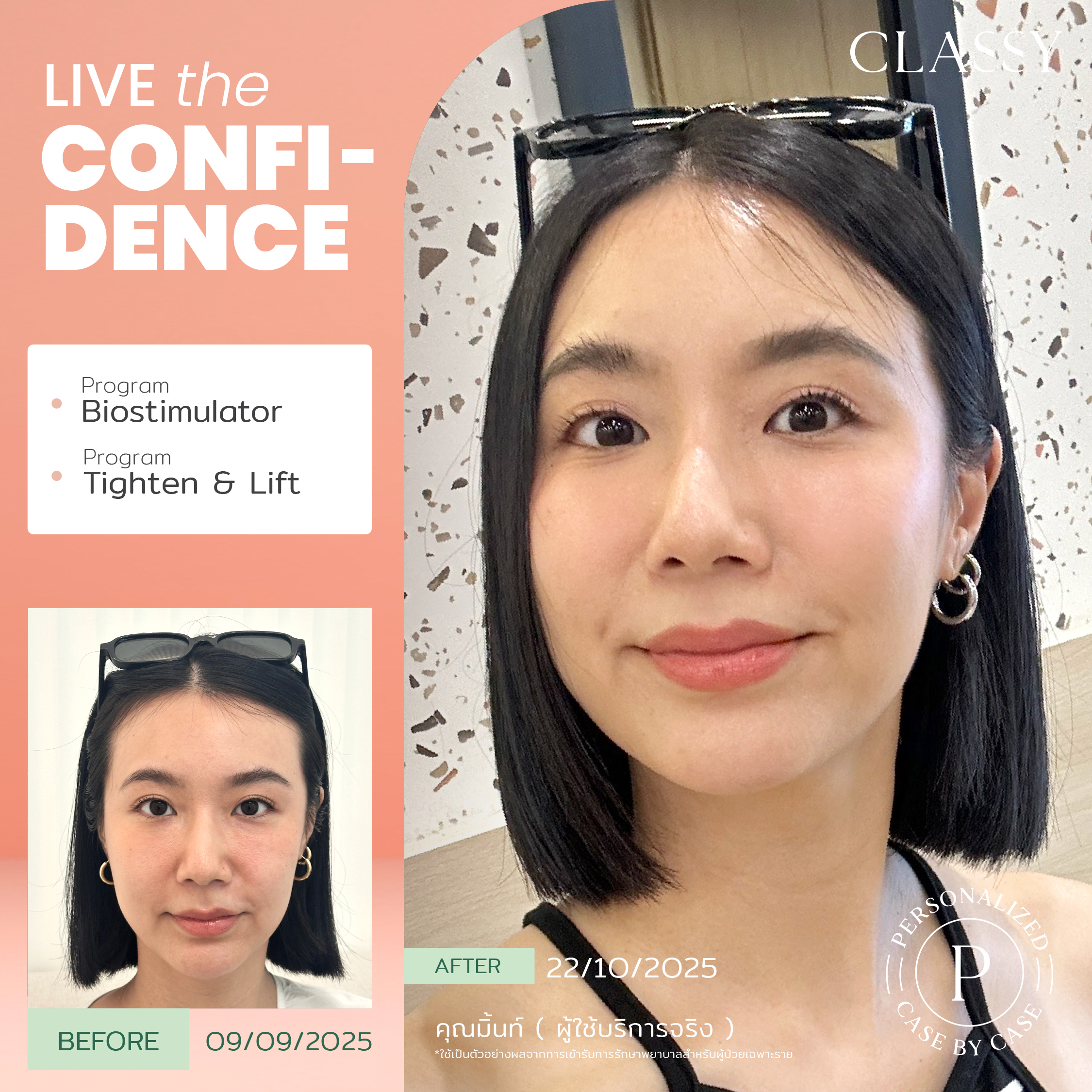 unbox - yourconfidence 67 BA live for confi set 6_Artboard 1 copy 7