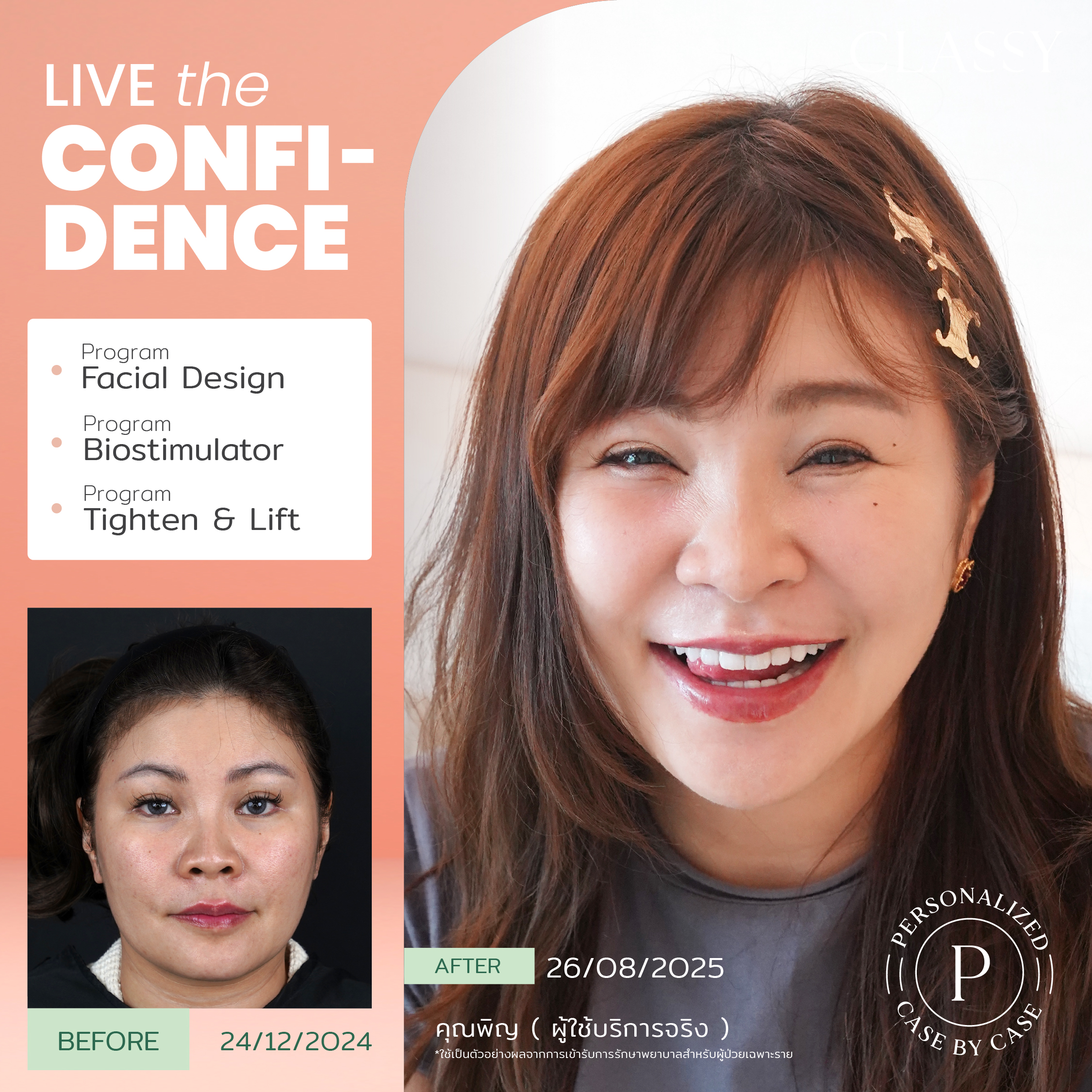 unbox - yourconfidence 44 BA live for confi set 6_Artboard 1 copy 8