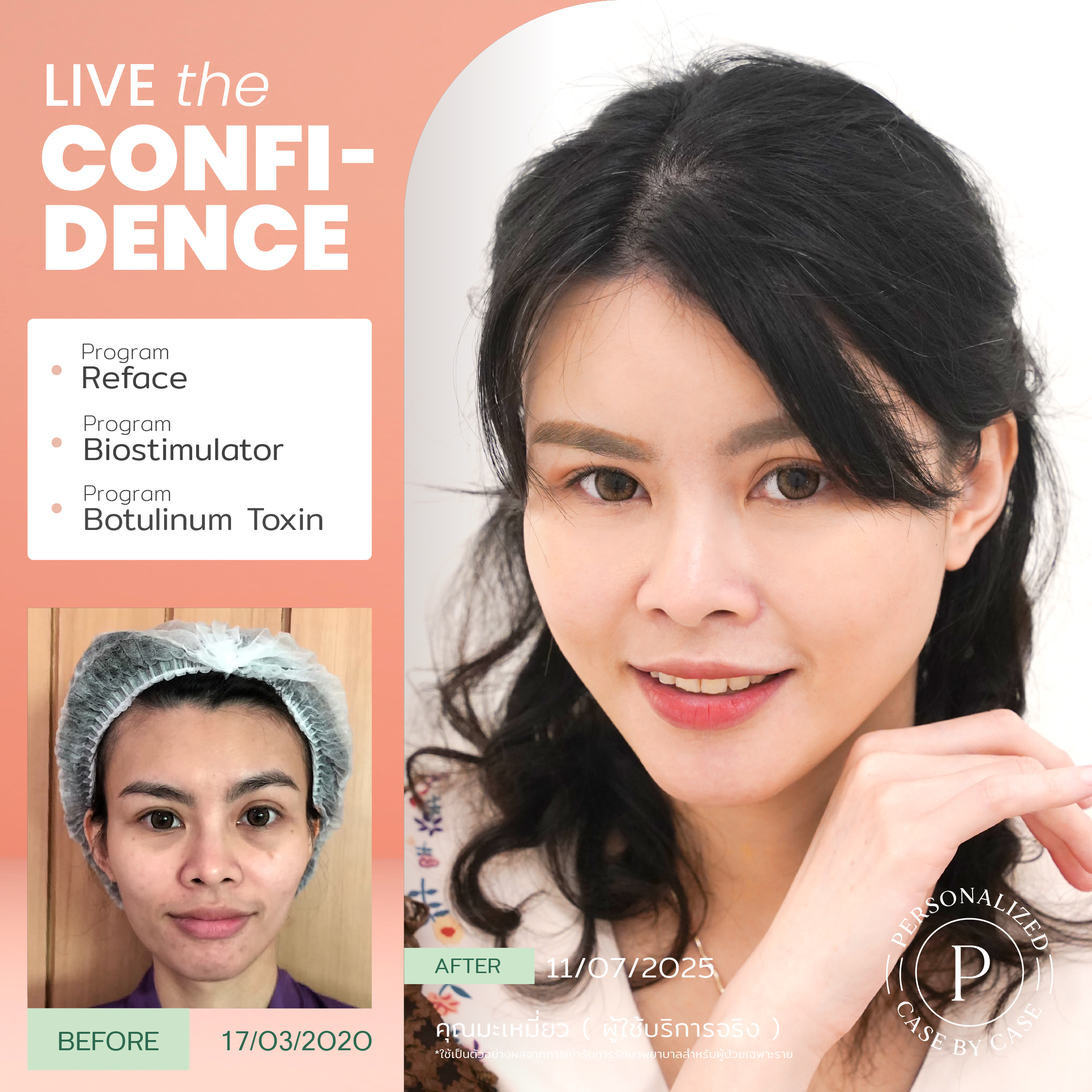 unbox - yourconfidence 52 BA live for confi set 7 _Artboard 1 copy 12