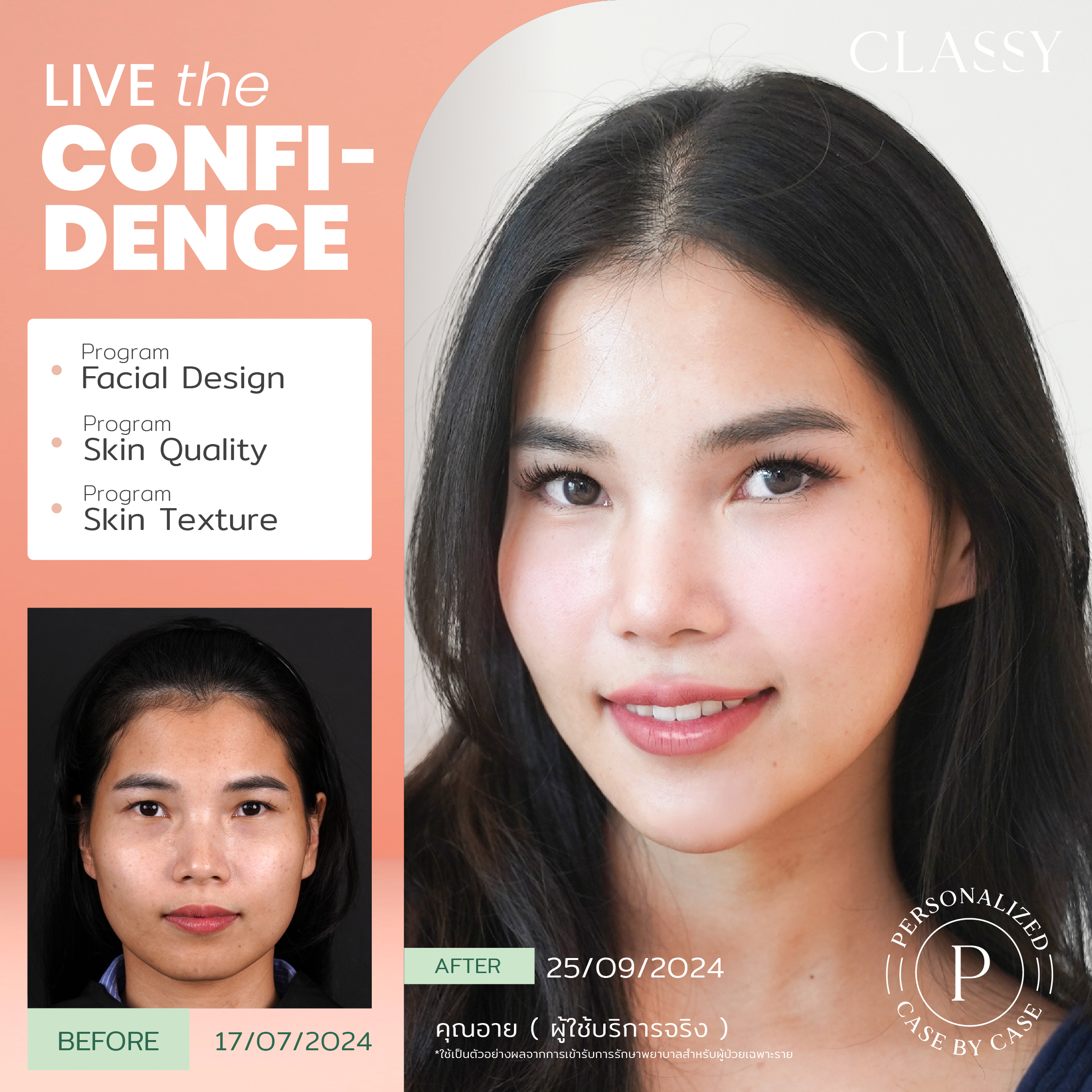 unbox - yourconfidence 12 set BA live for confidence-02