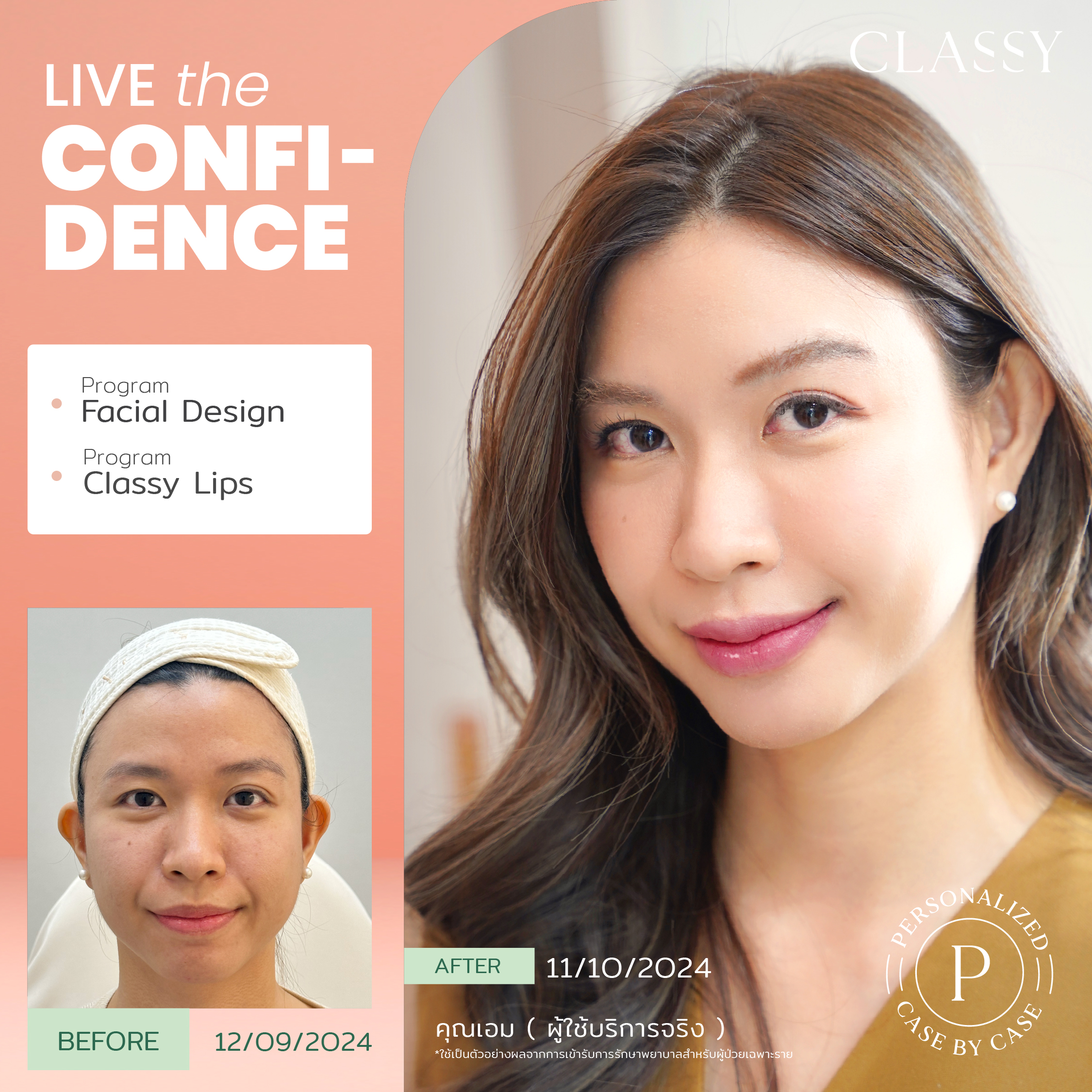 unbox - yourconfidence 11 set BA live for confidence-03