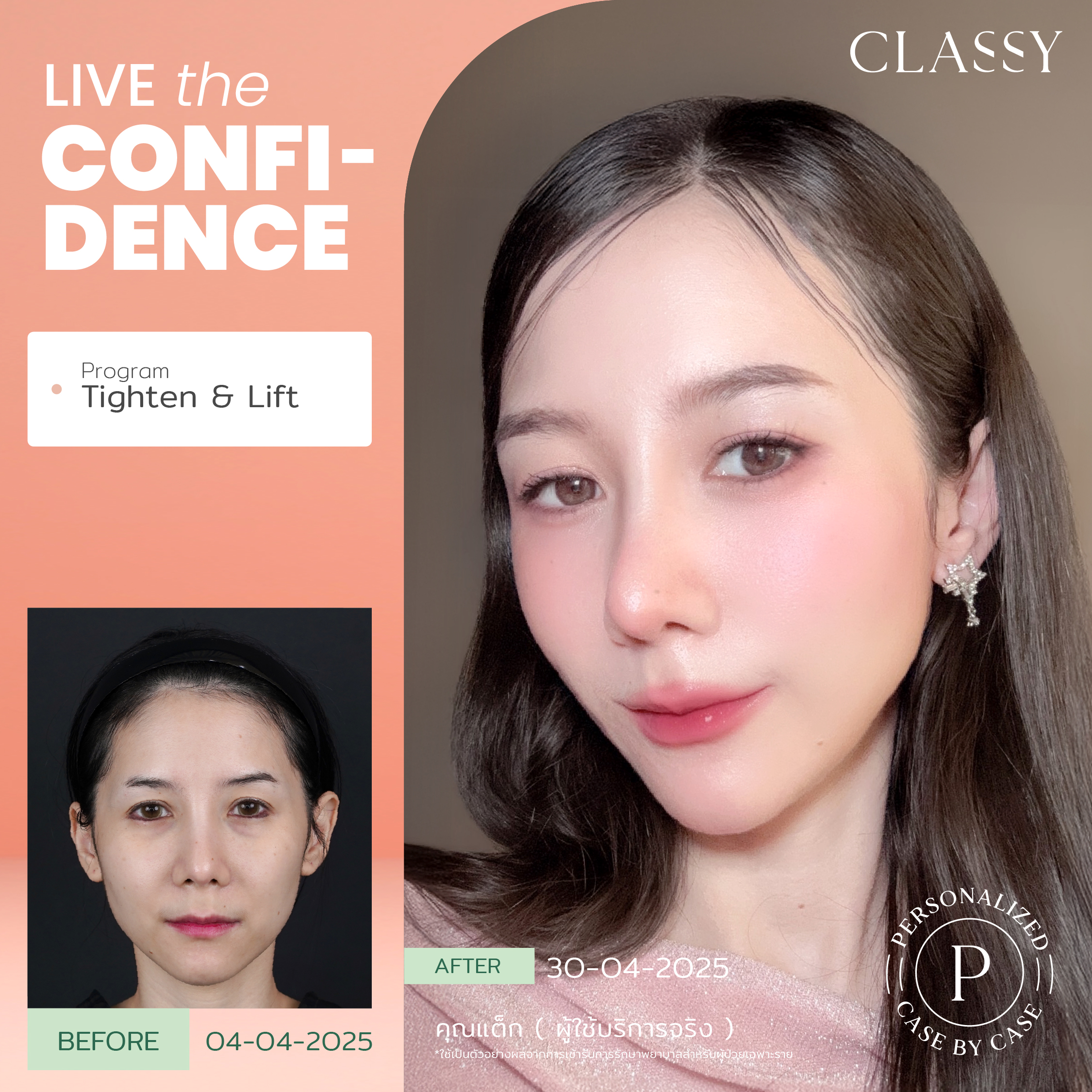 unbox - yourconfidence 39 set BA live for confidence-04