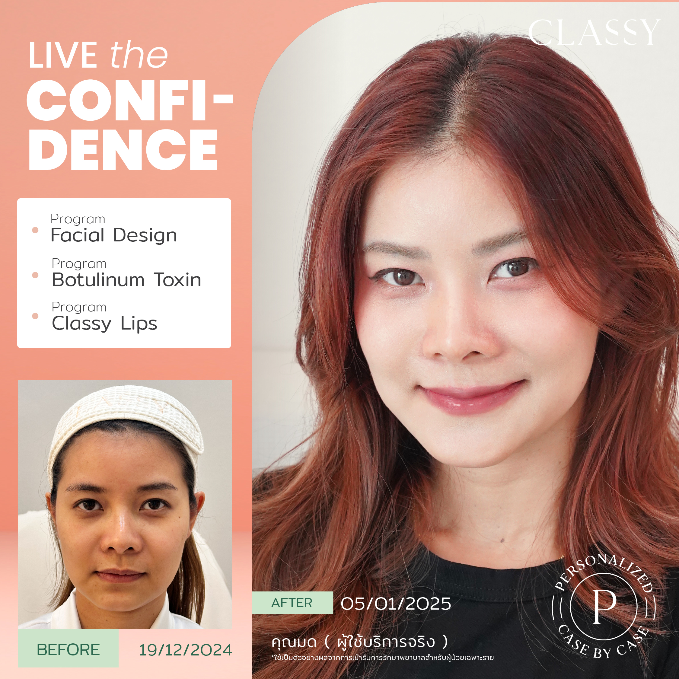 unbox - yourconfidence 14 set BA live for confidence-05