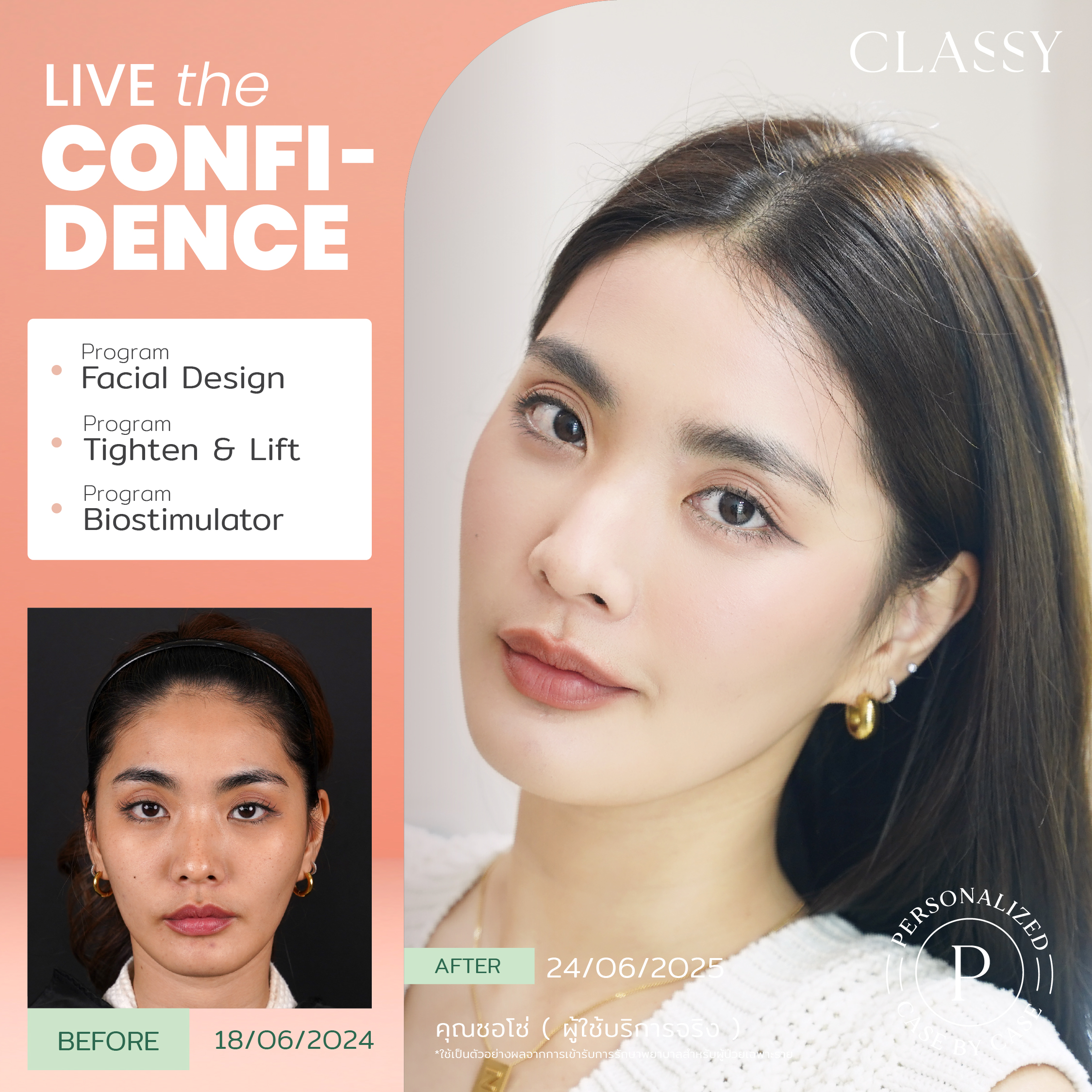 unbox - yourconfidence 50 set BA live for confidence-06