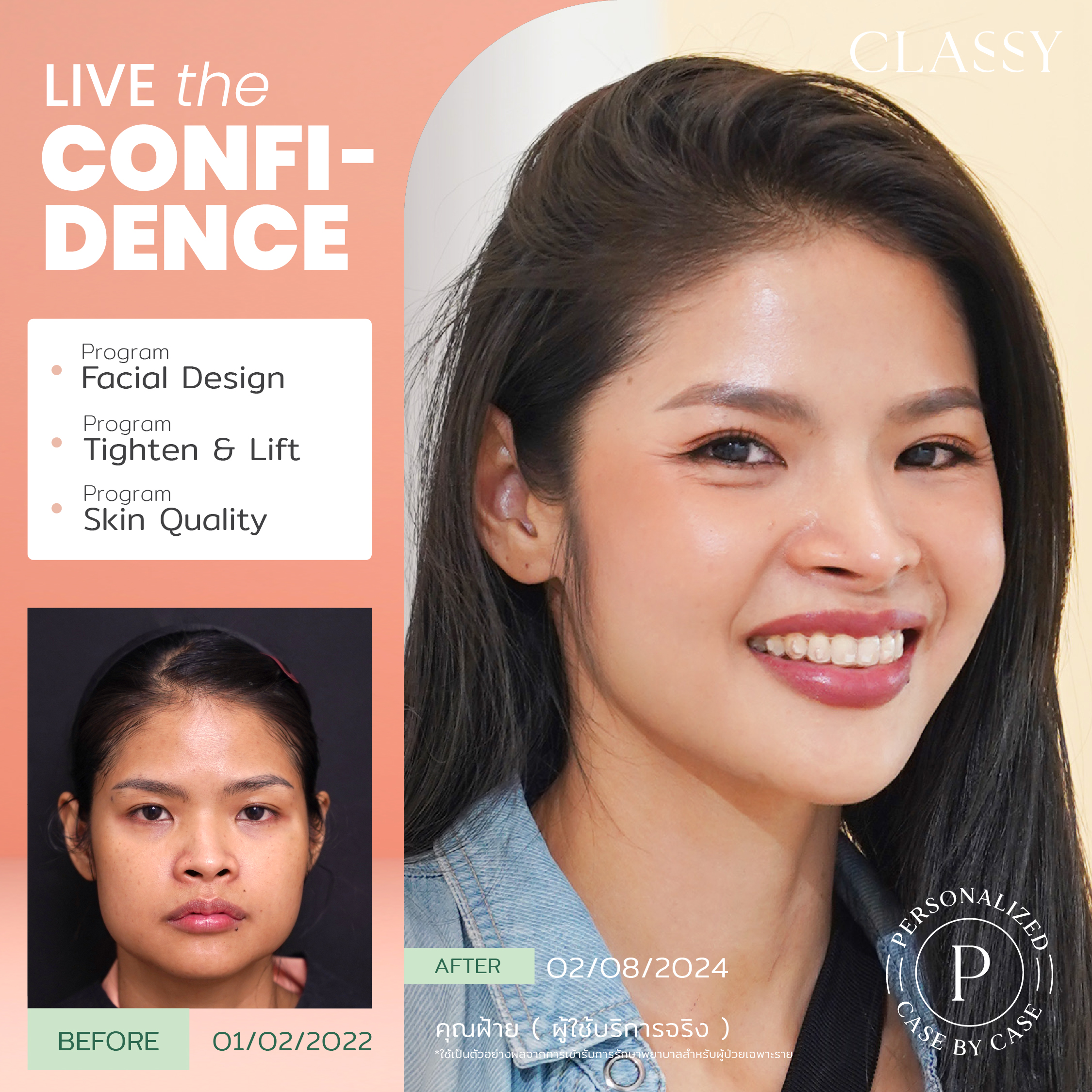 unbox - yourconfidence 13 set BA live for confidence set 2 _Artboard 1 copy 11