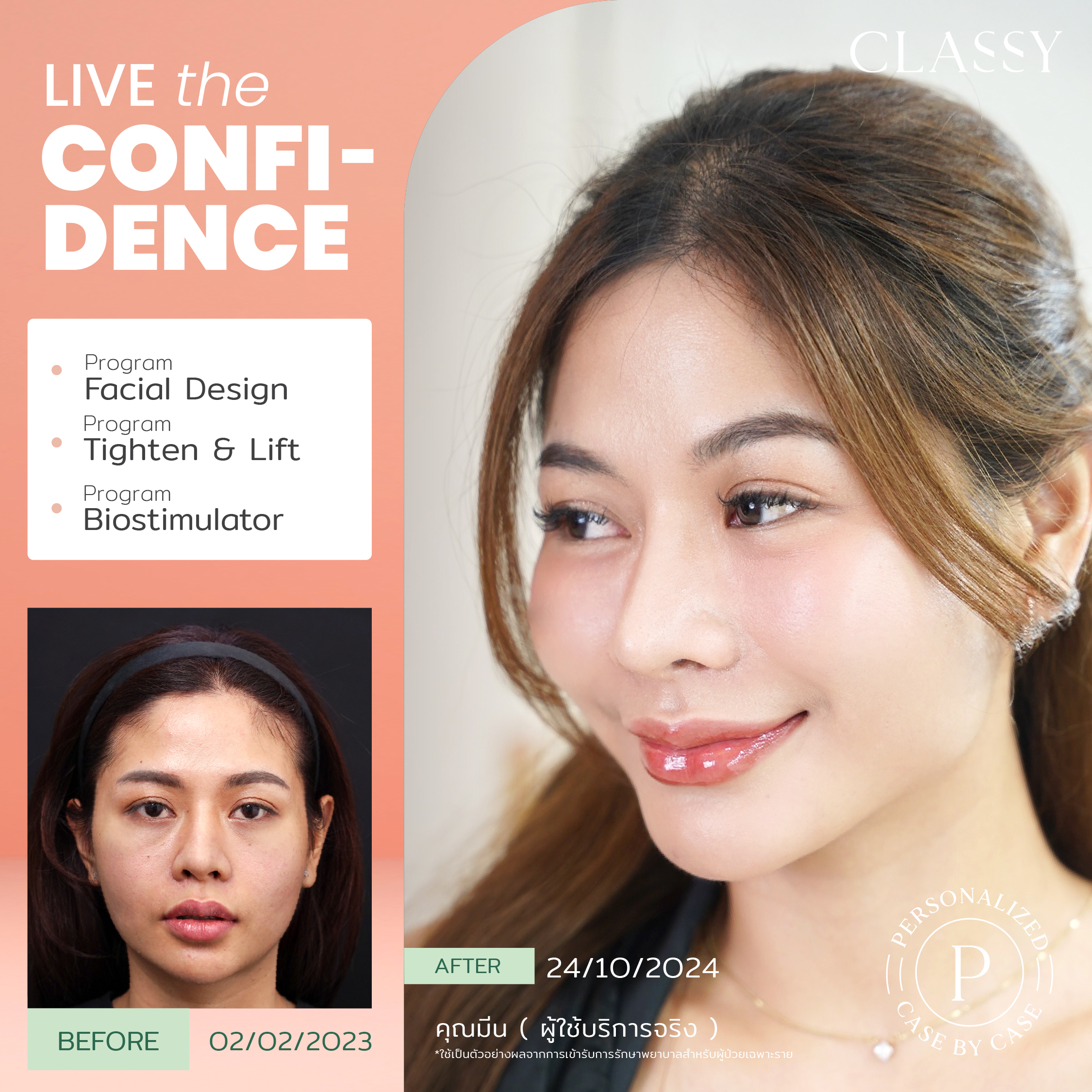 unbox - yourconfidence 78 set BA live for confidence set 2 _Artboard 1 copy 4