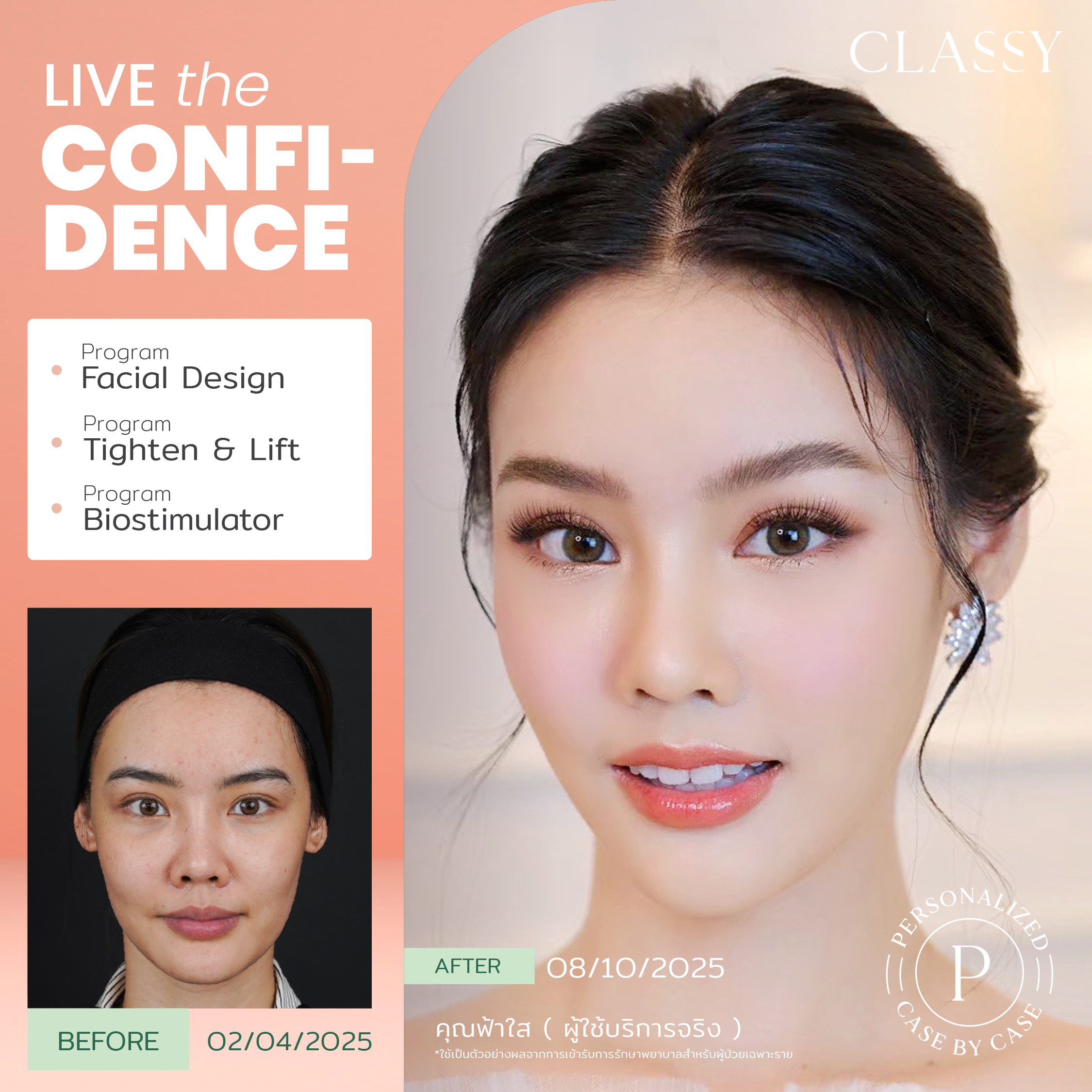 unbox - yourconfidence 80 set BA live for confidence set 2 _Artboard 1 copy 7