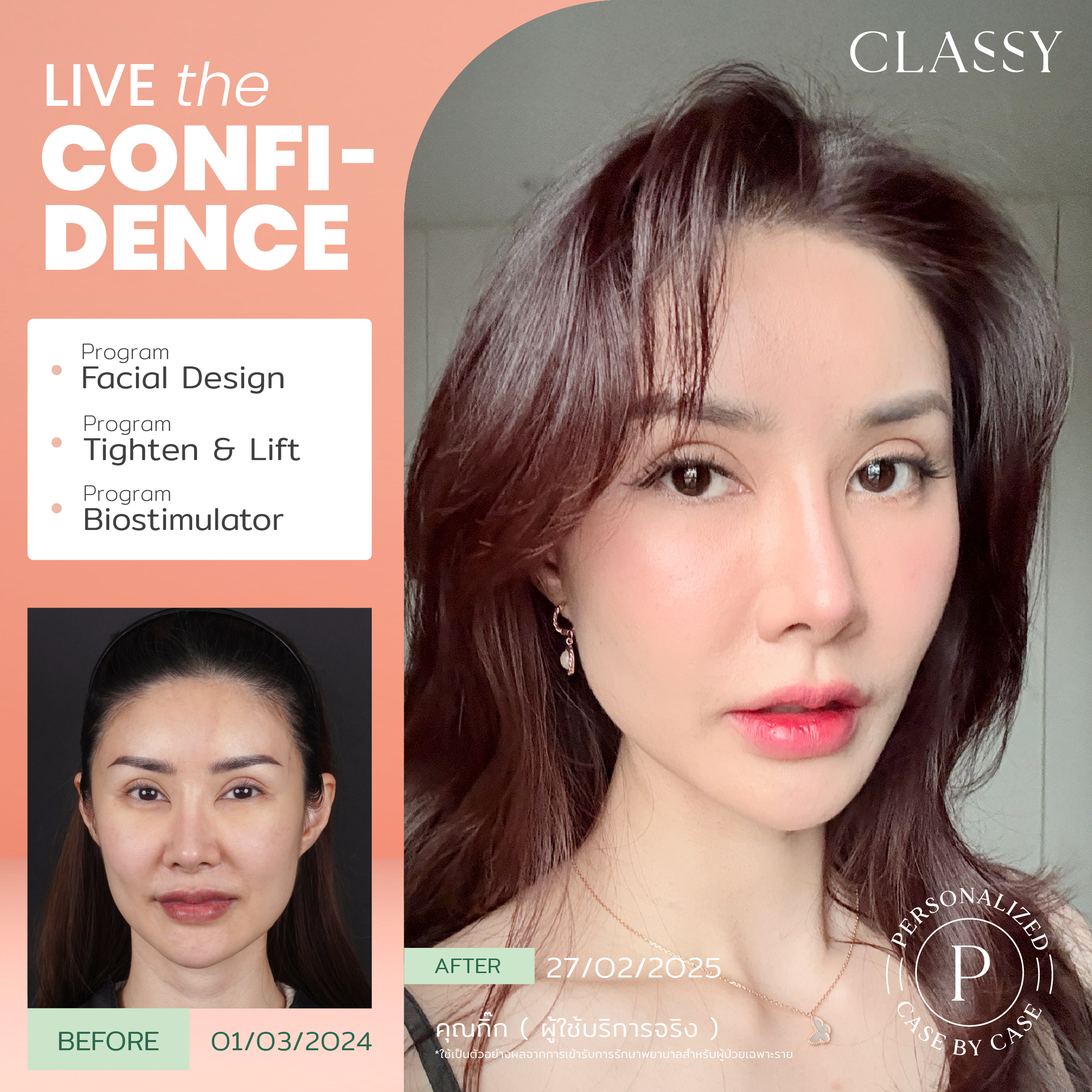 unbox - yourconfidence 74 set BA live for confidence set 3 -01