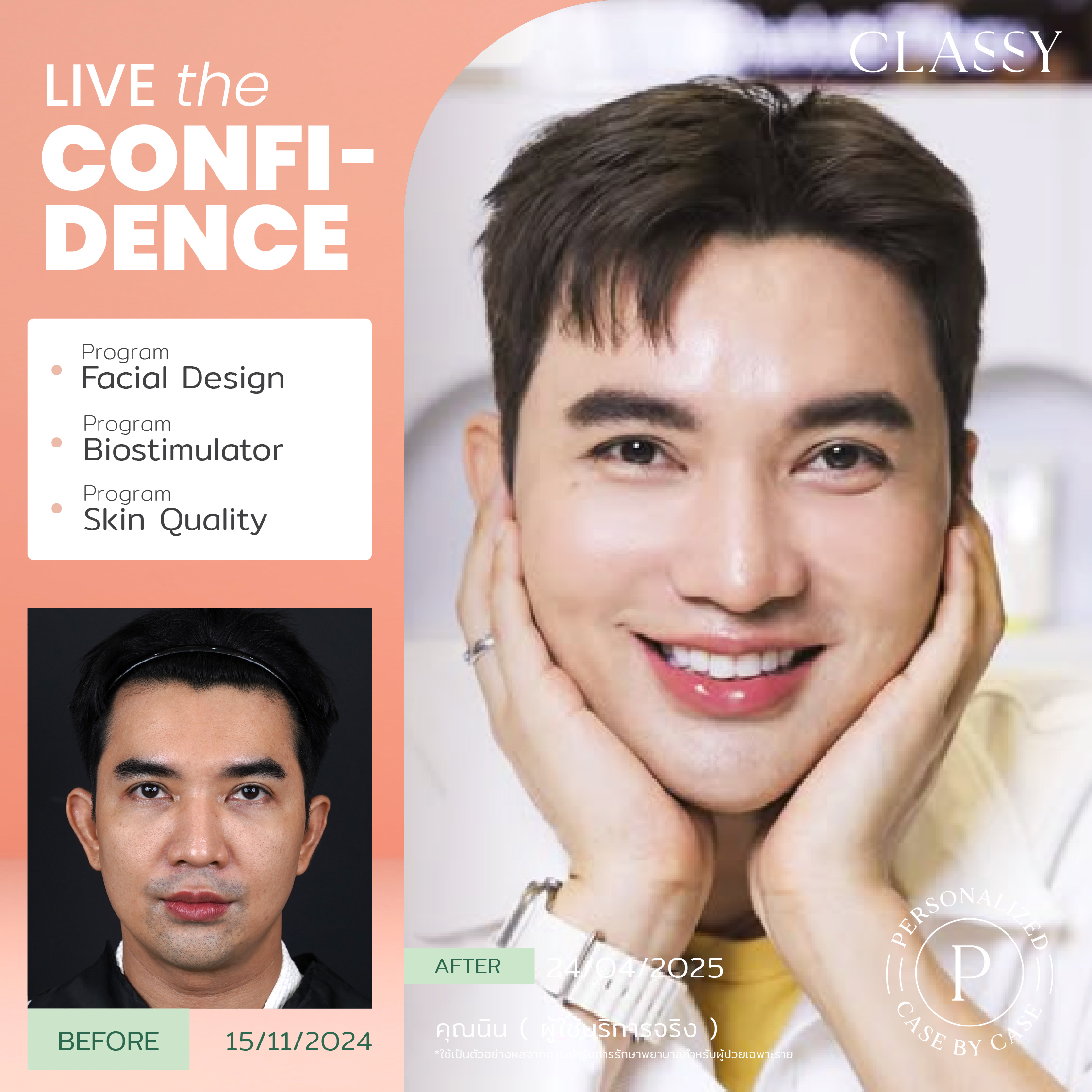 unbox - yourconfidence 64 set BA live for confidence set 3 -02