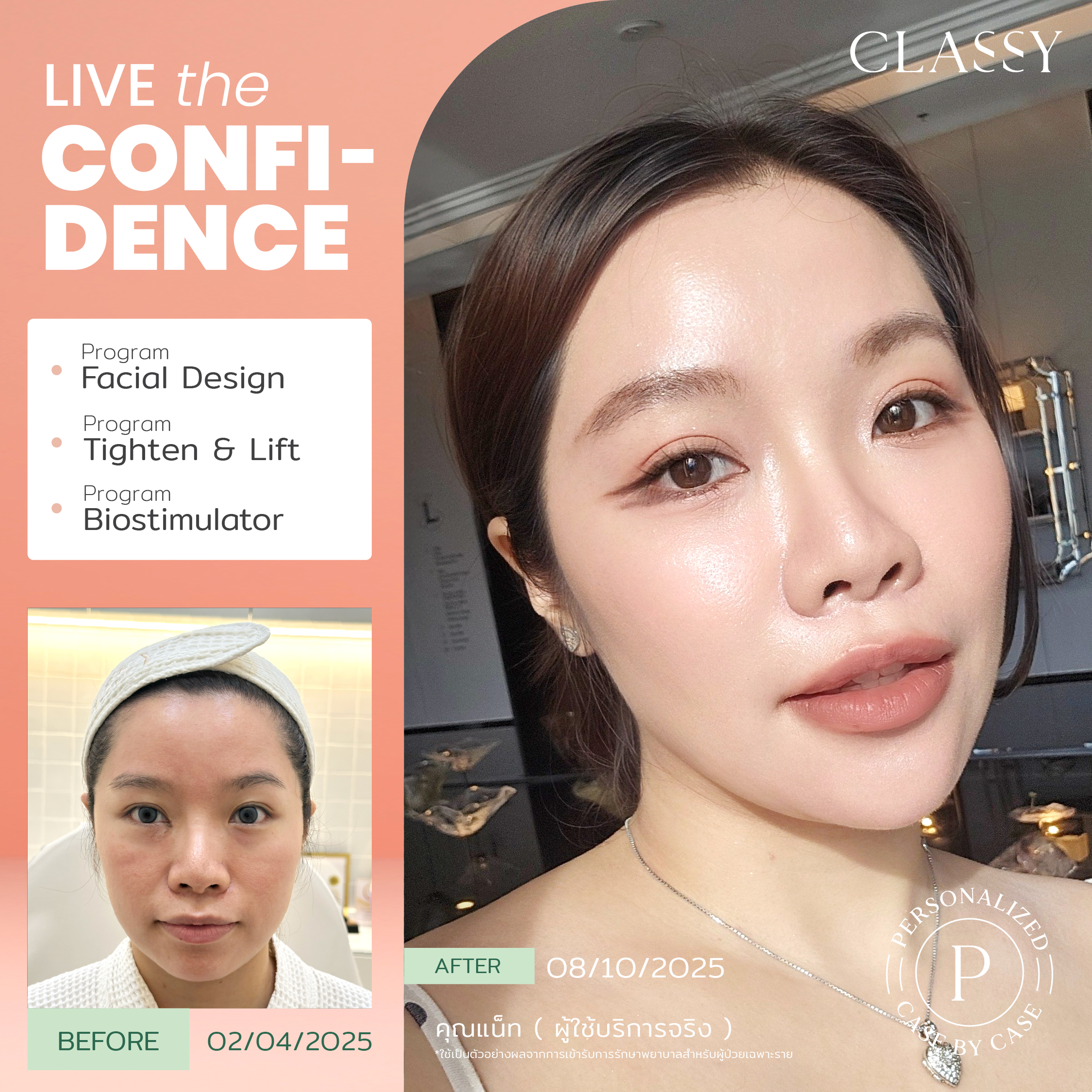 unbox - yourconfidence 7 set BA live for confidence set 3 -03