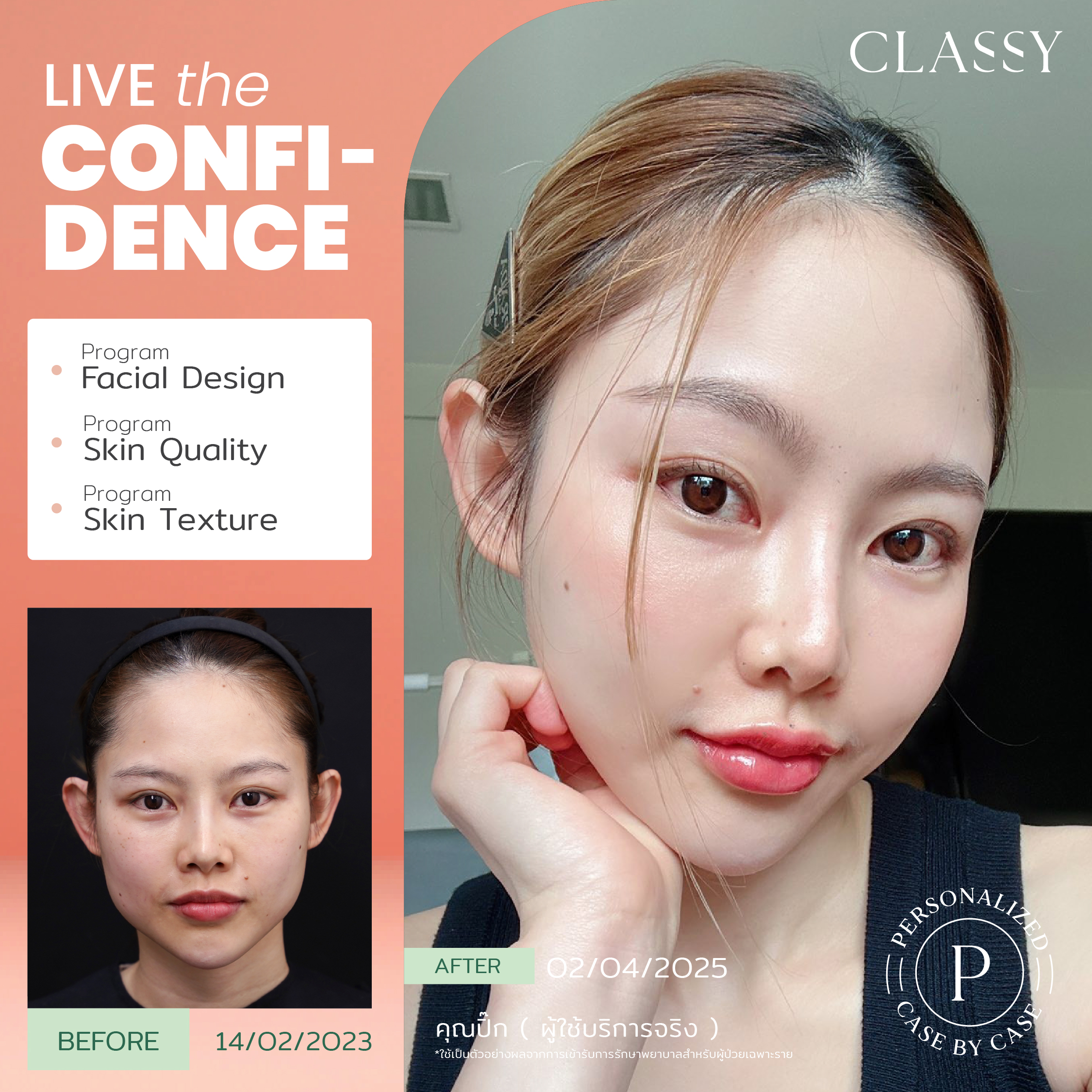 set BA live for confidence set 3 -05