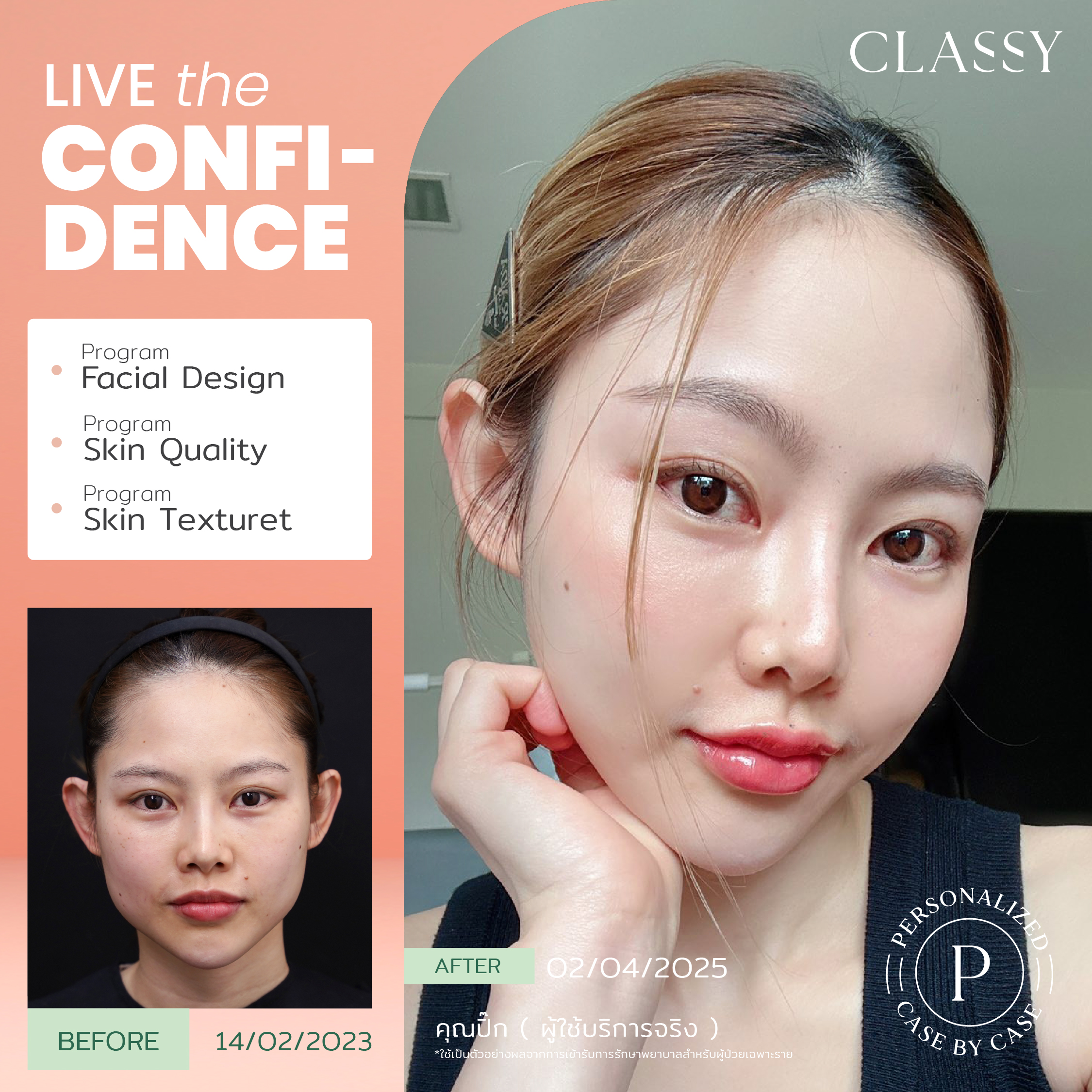 unbox - yourconfidence 9 set BA live for confidence set 3 -05