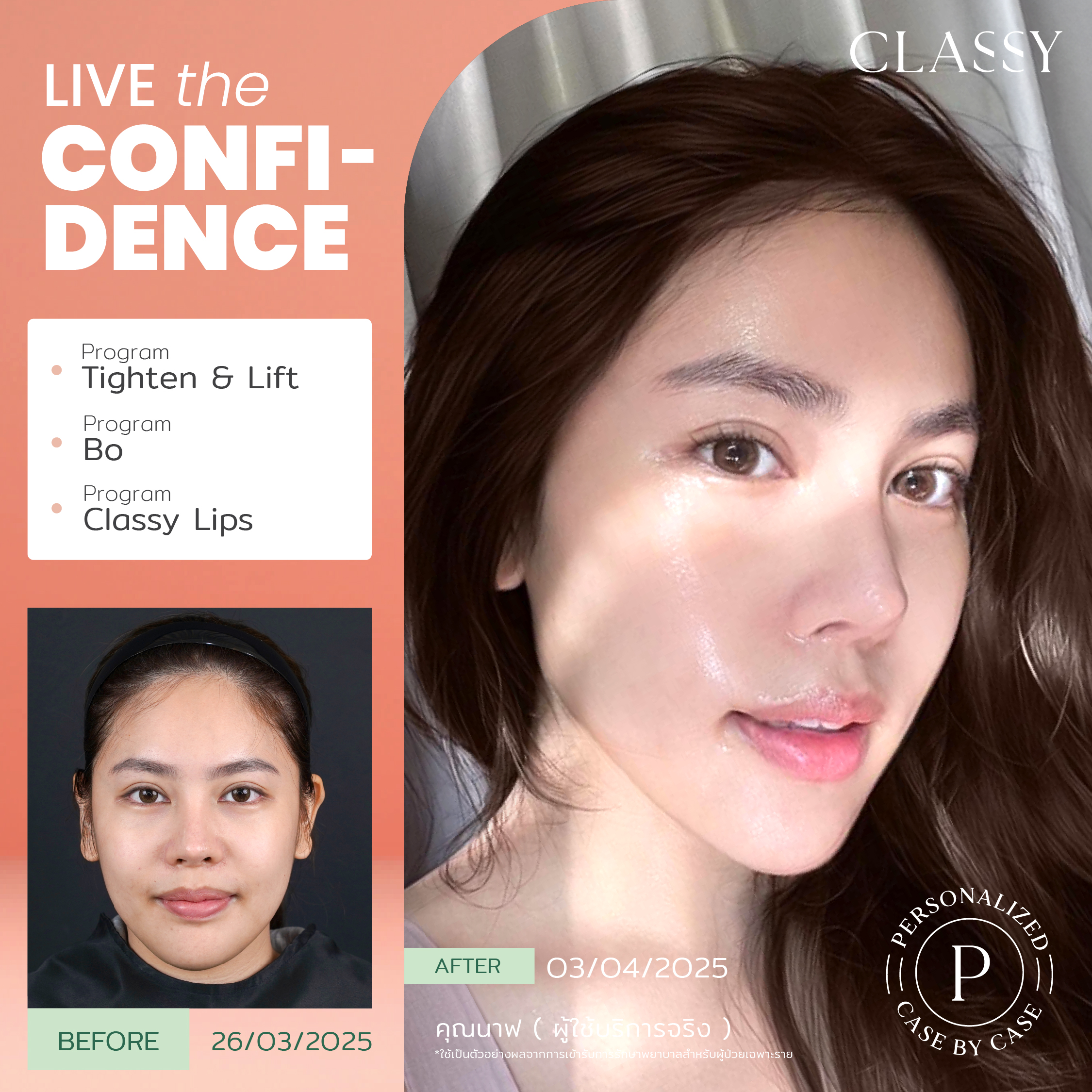 set BA live for confidence set 3 -06