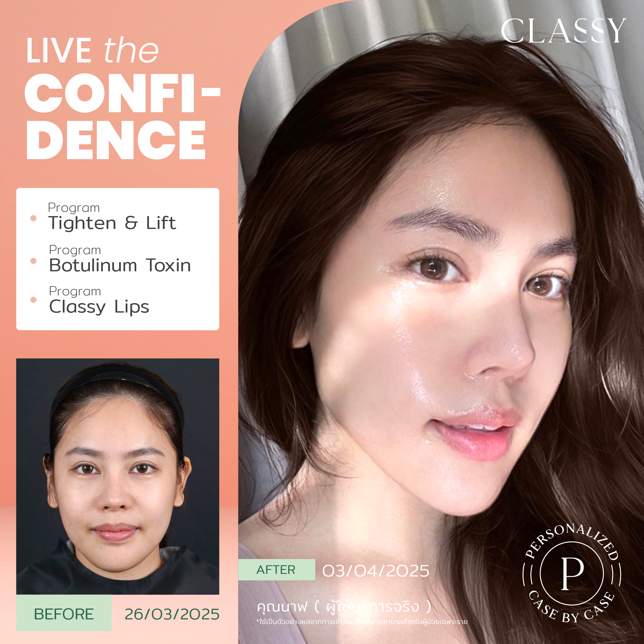 unbox - yourconfidence 38 set BA live for confidence set 3 -06