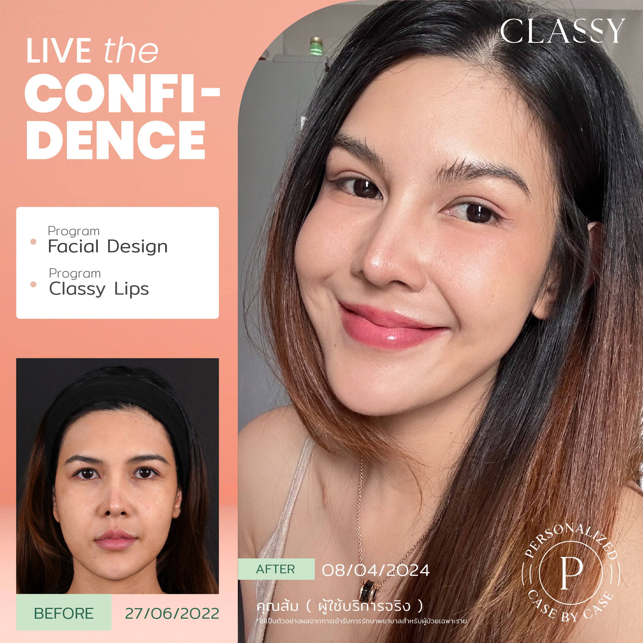 unbox - yourconfidence 25 set BA live for confidence set 4-01