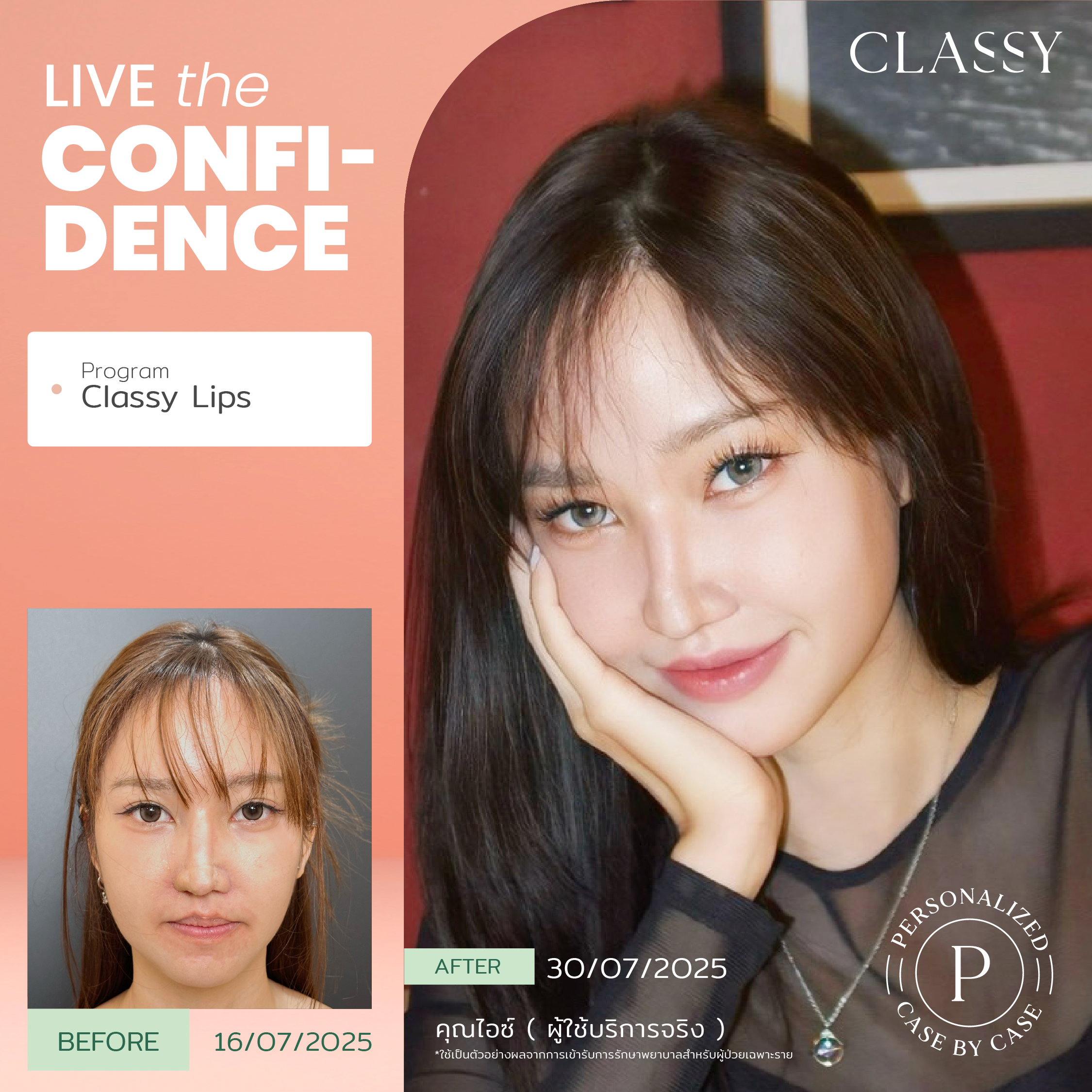 unbox - yourconfidence 22 set BA live for confidence set 4-04