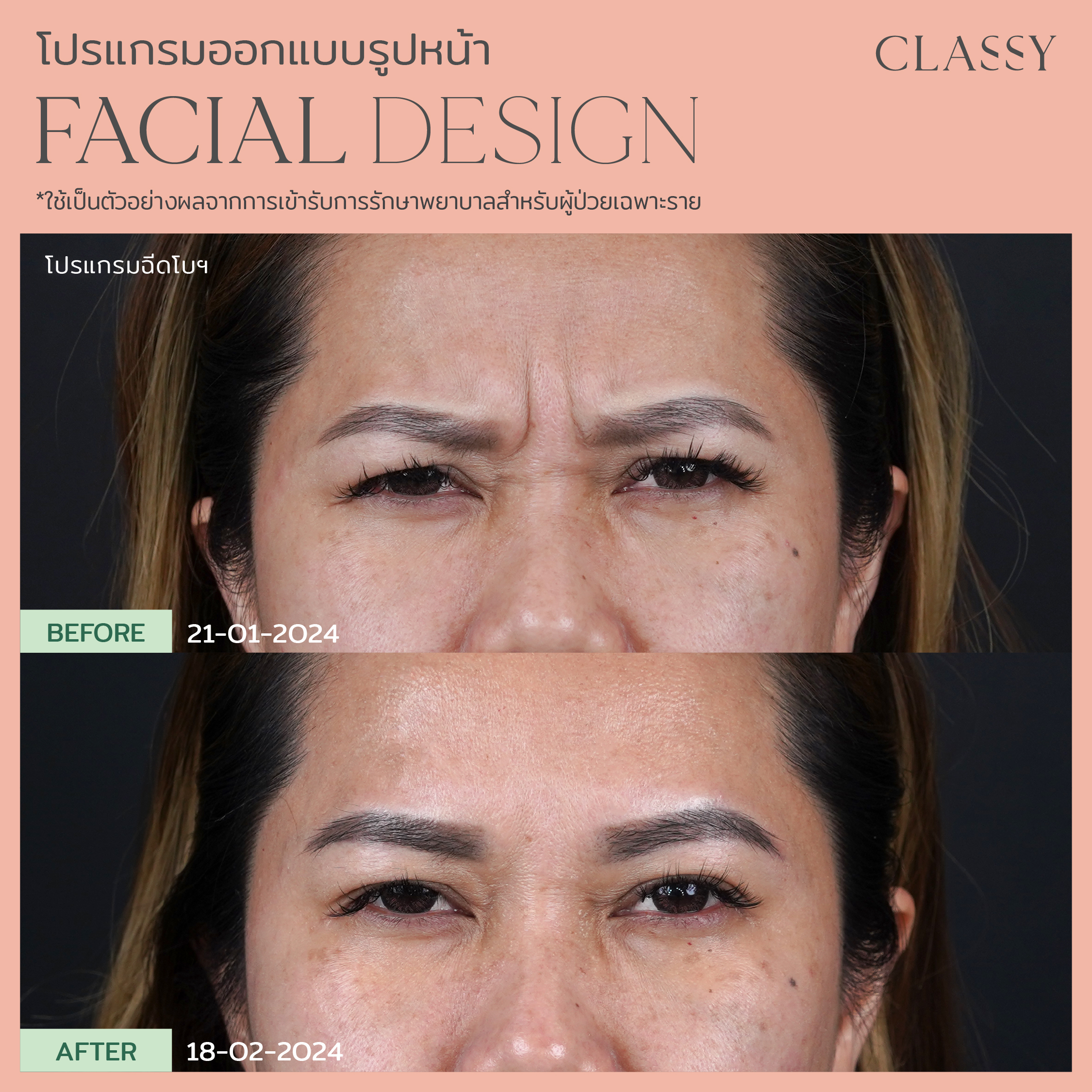 พี่กวาง -07