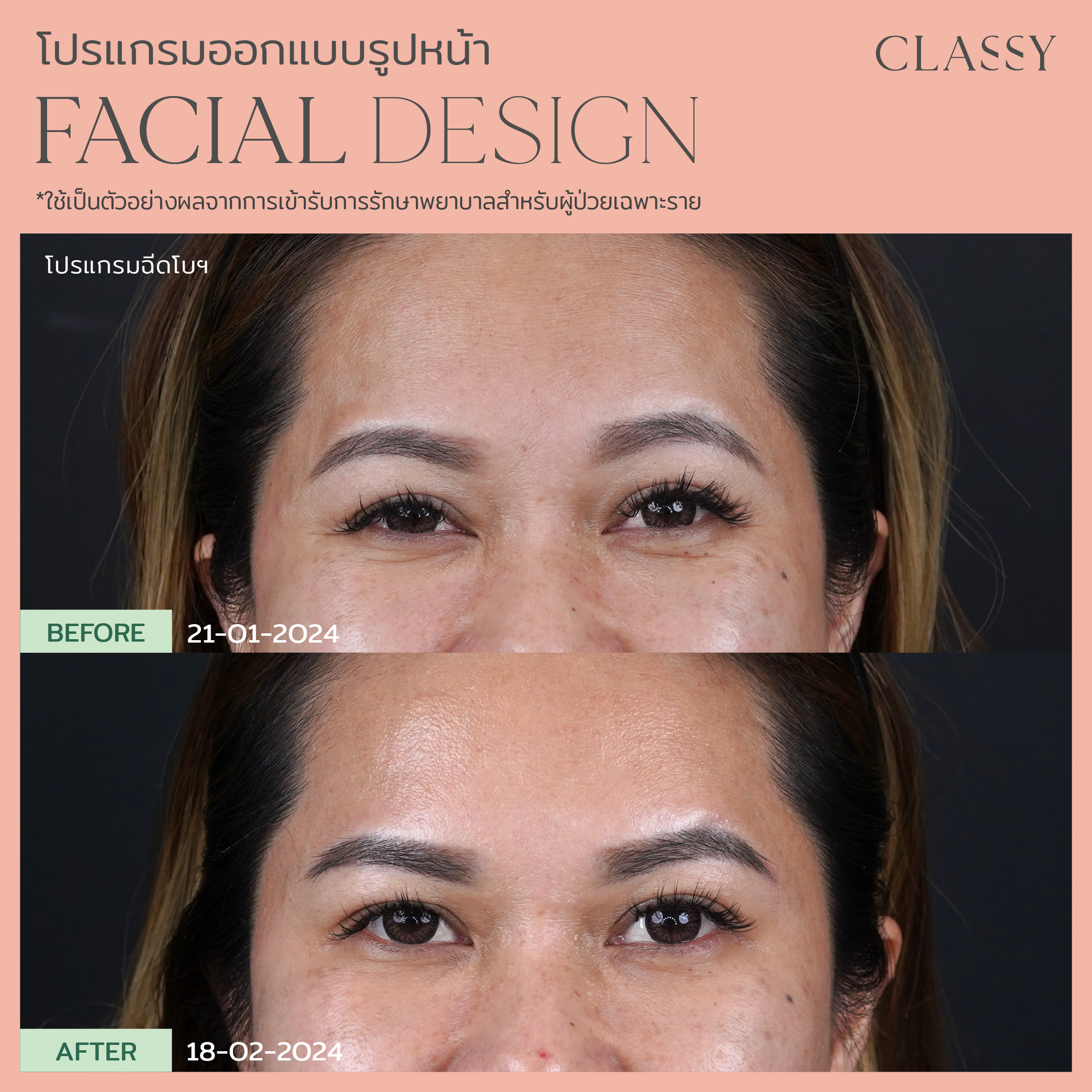 พี่กวาง -17