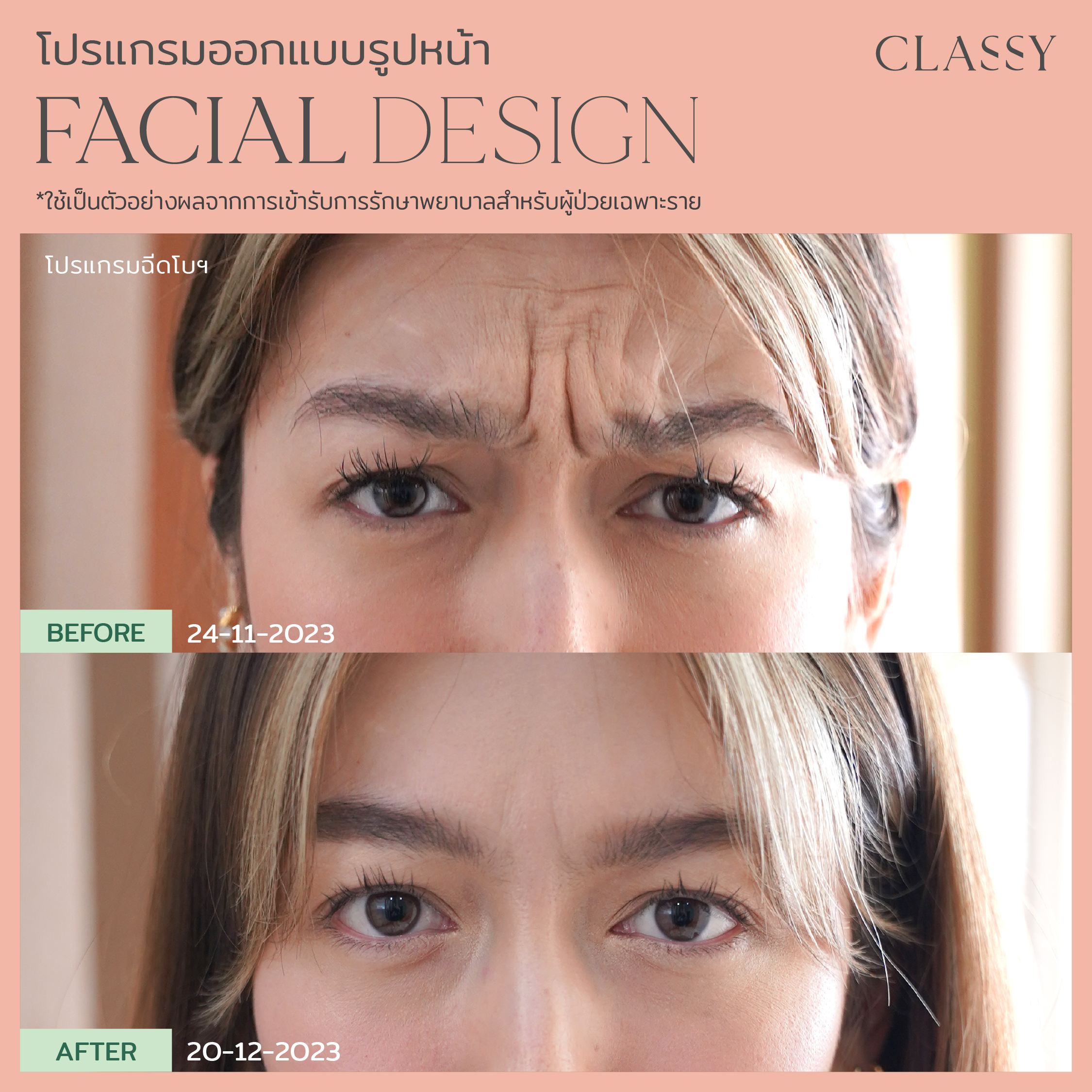 อันเน็ต-07