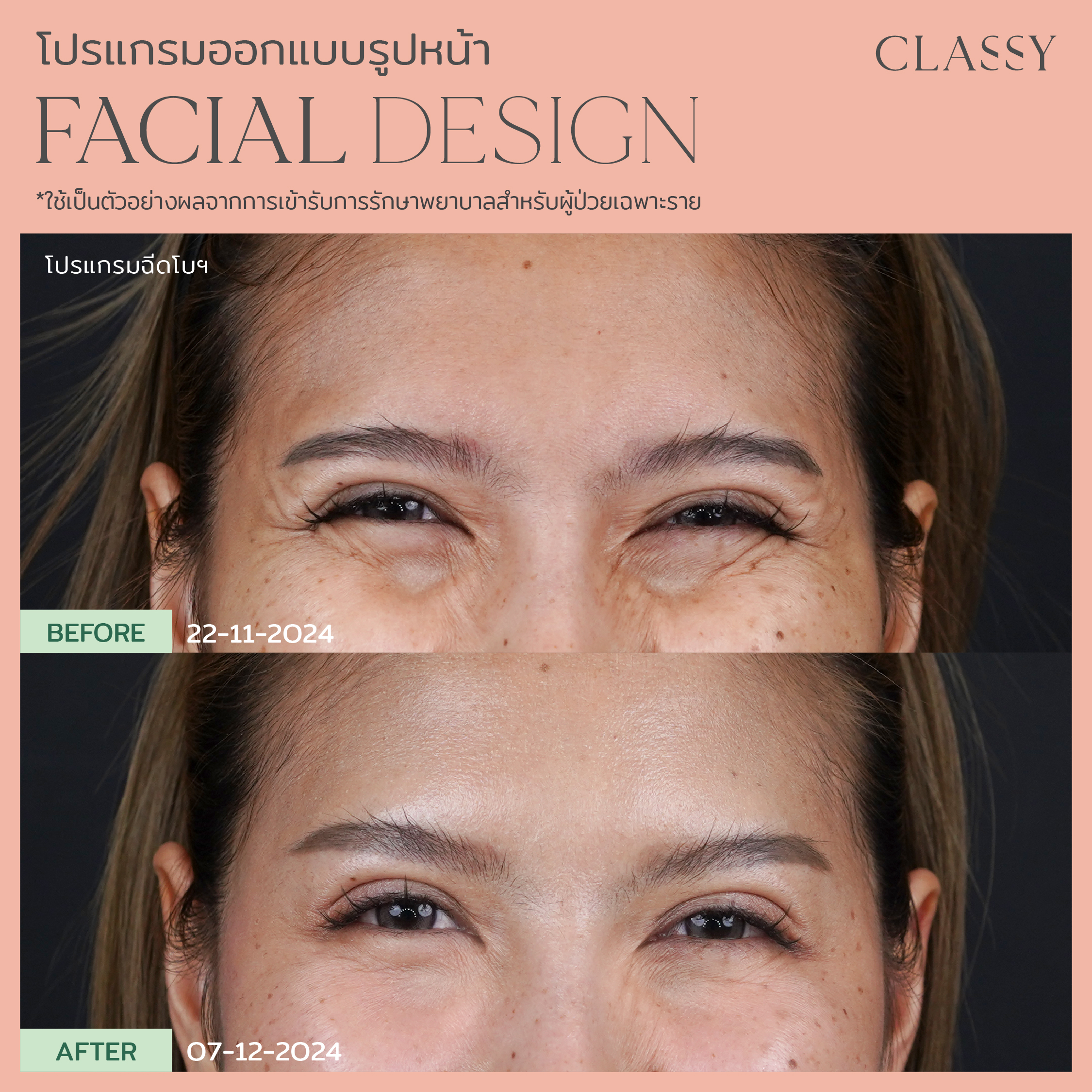 อ้อมแอ้ม-07