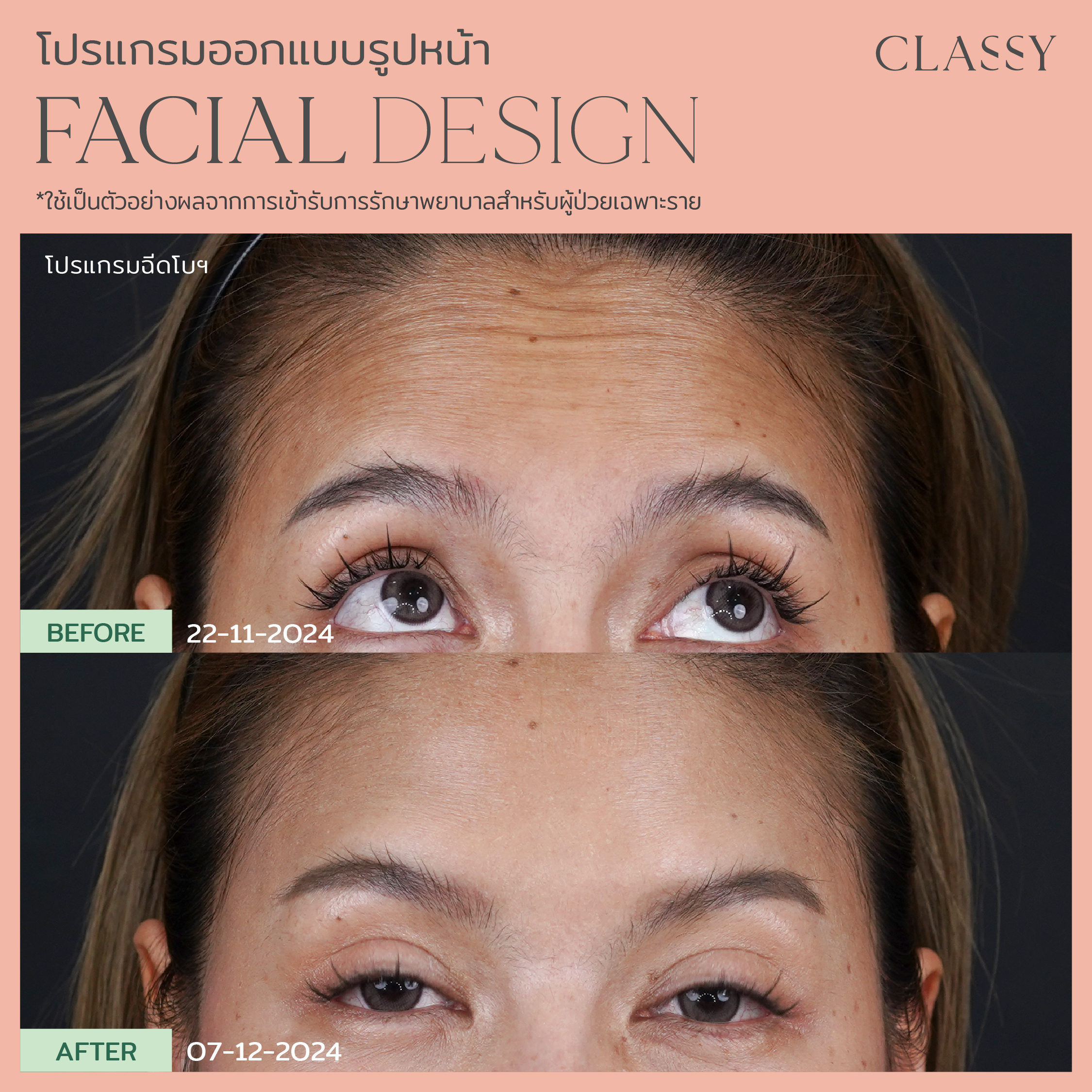 อ้อมแอ้ม-19