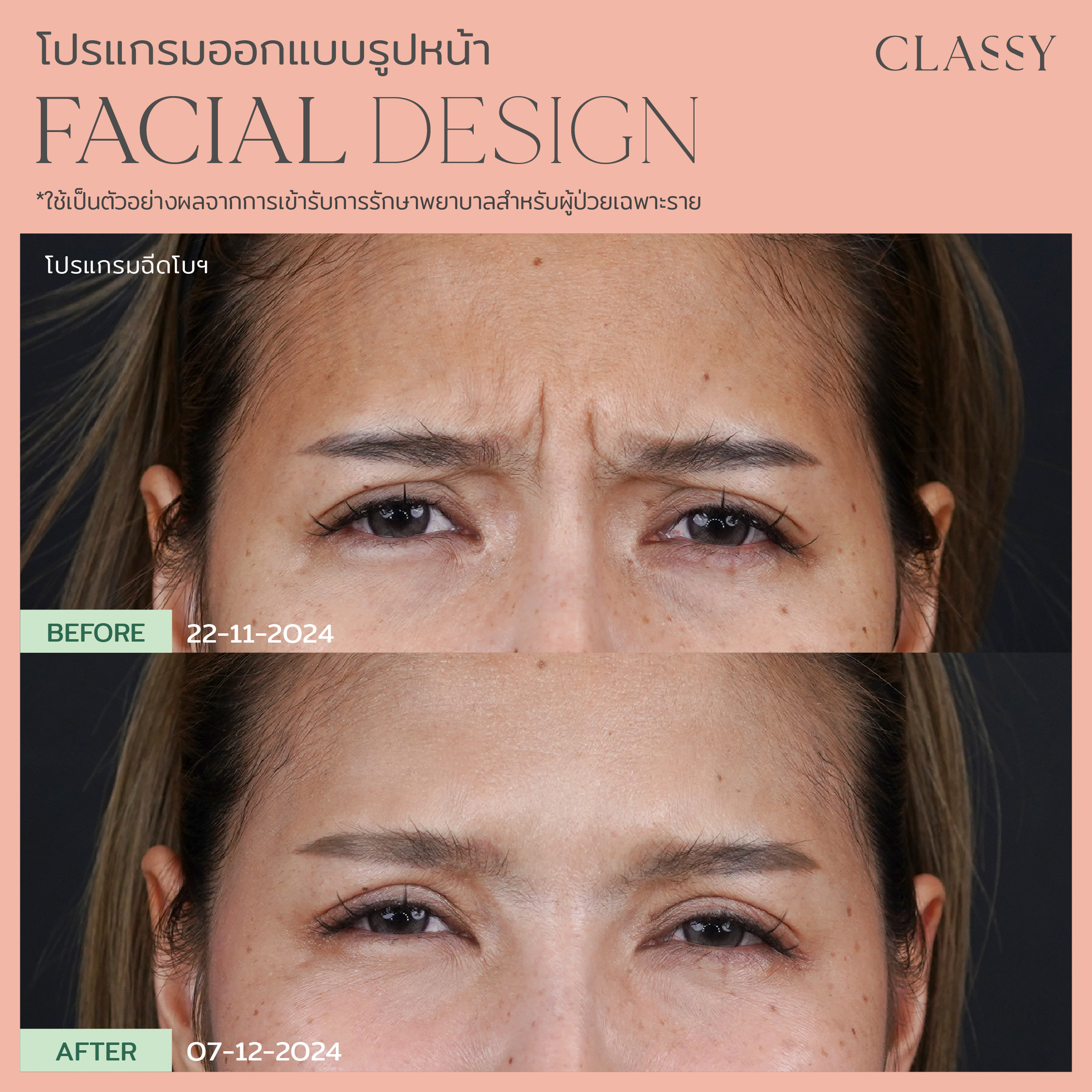 อ้อมแอ้ม-20