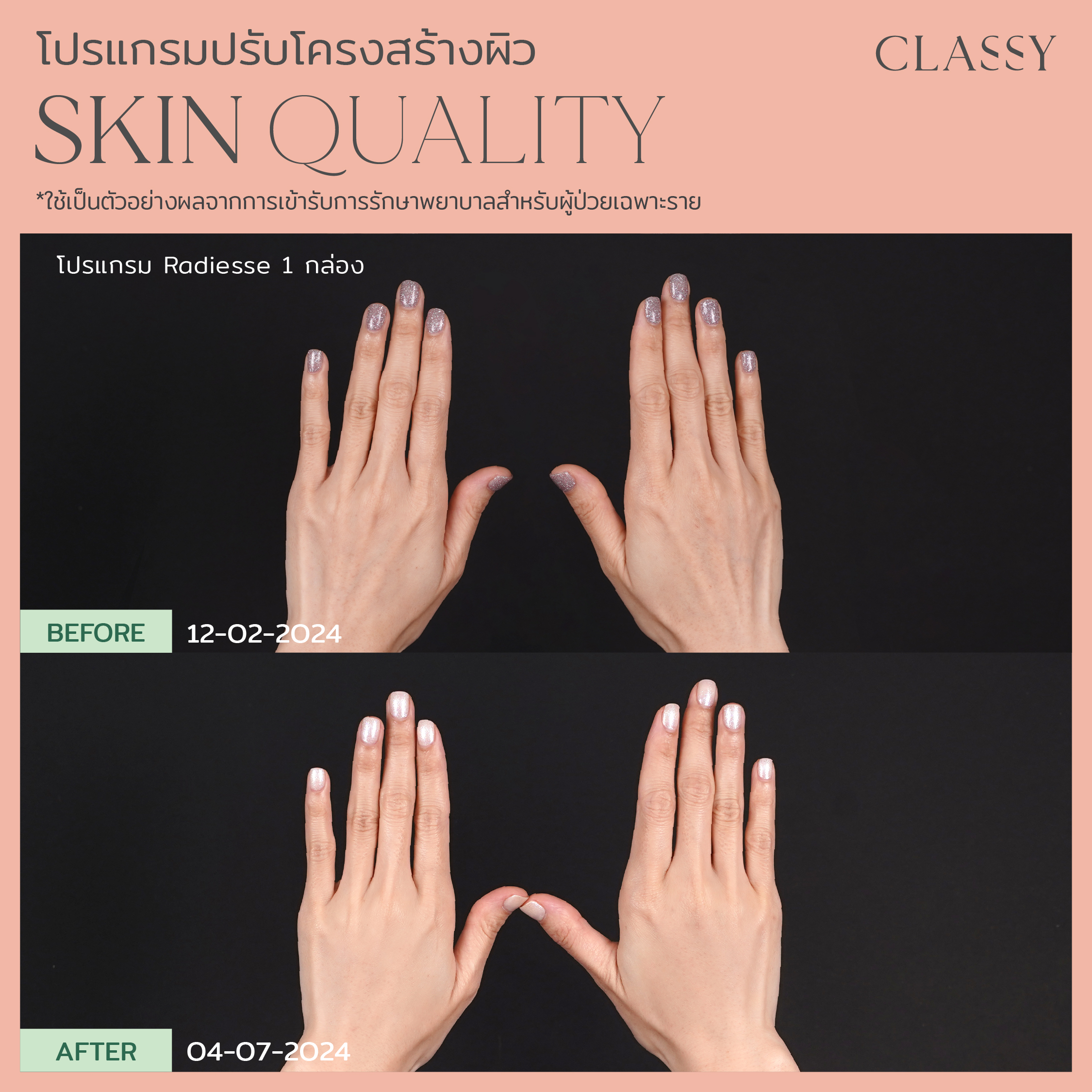 BA SKIN QUALITY-02