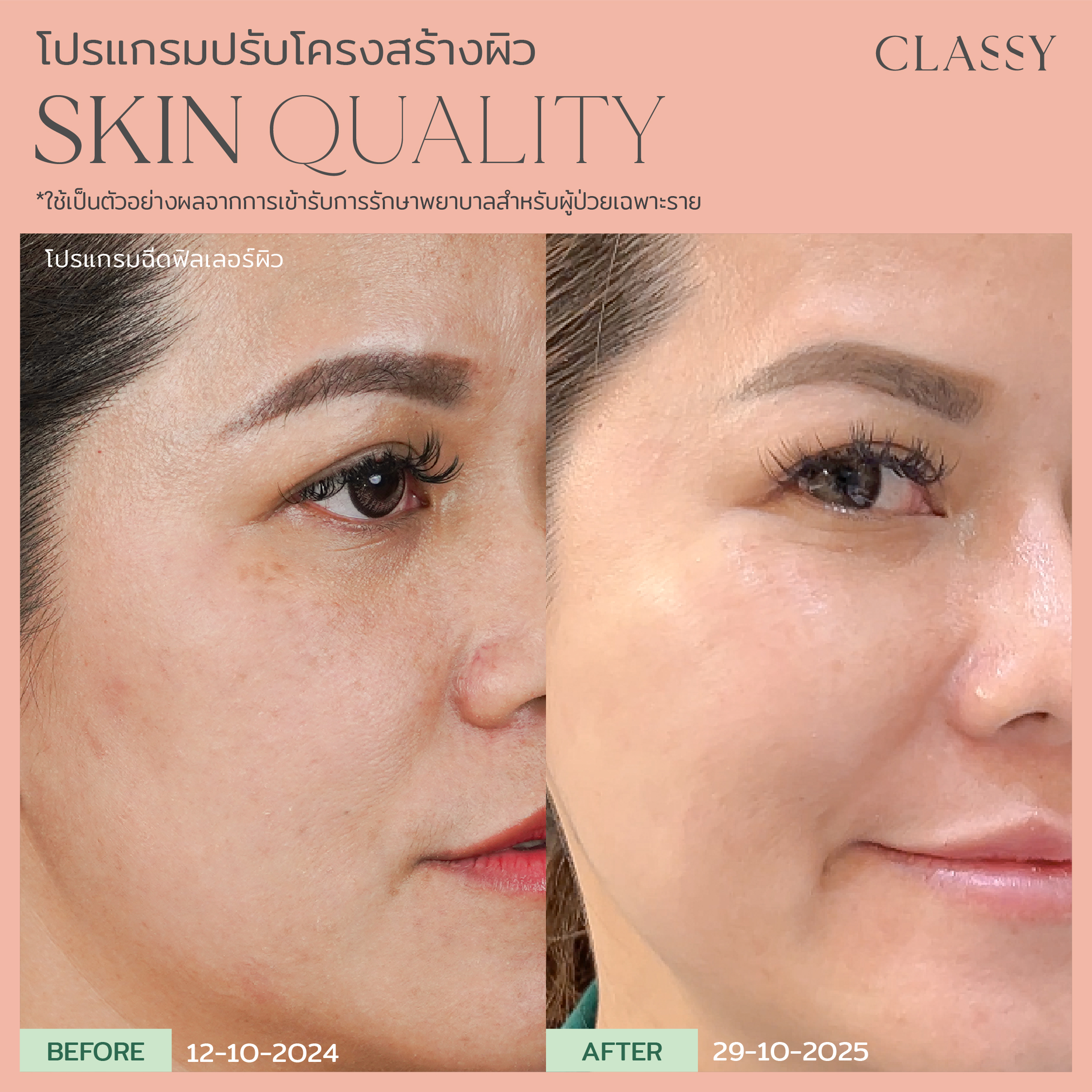 BA SKIN QUALITY-03_0