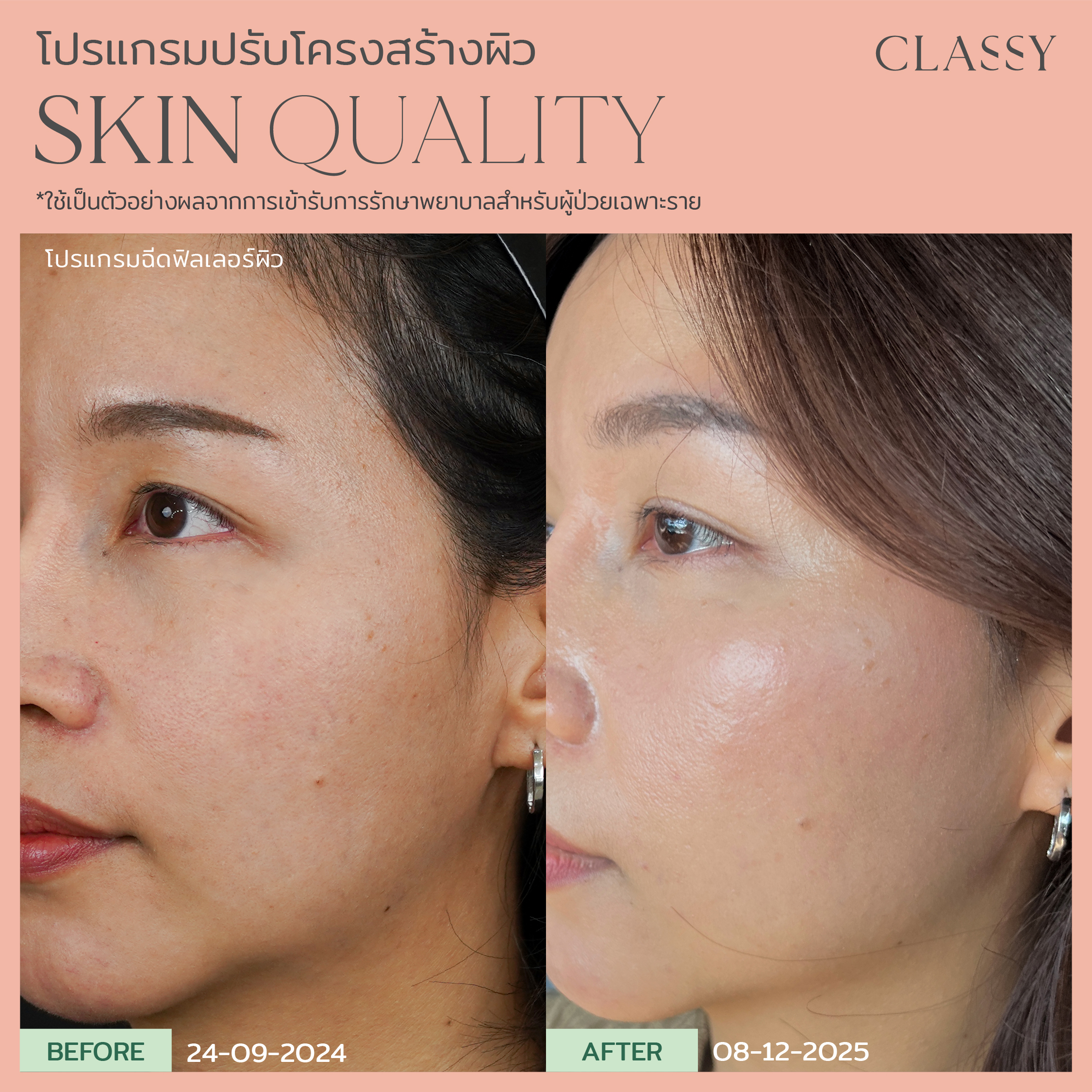 BA SKIN QUALITY-03_2