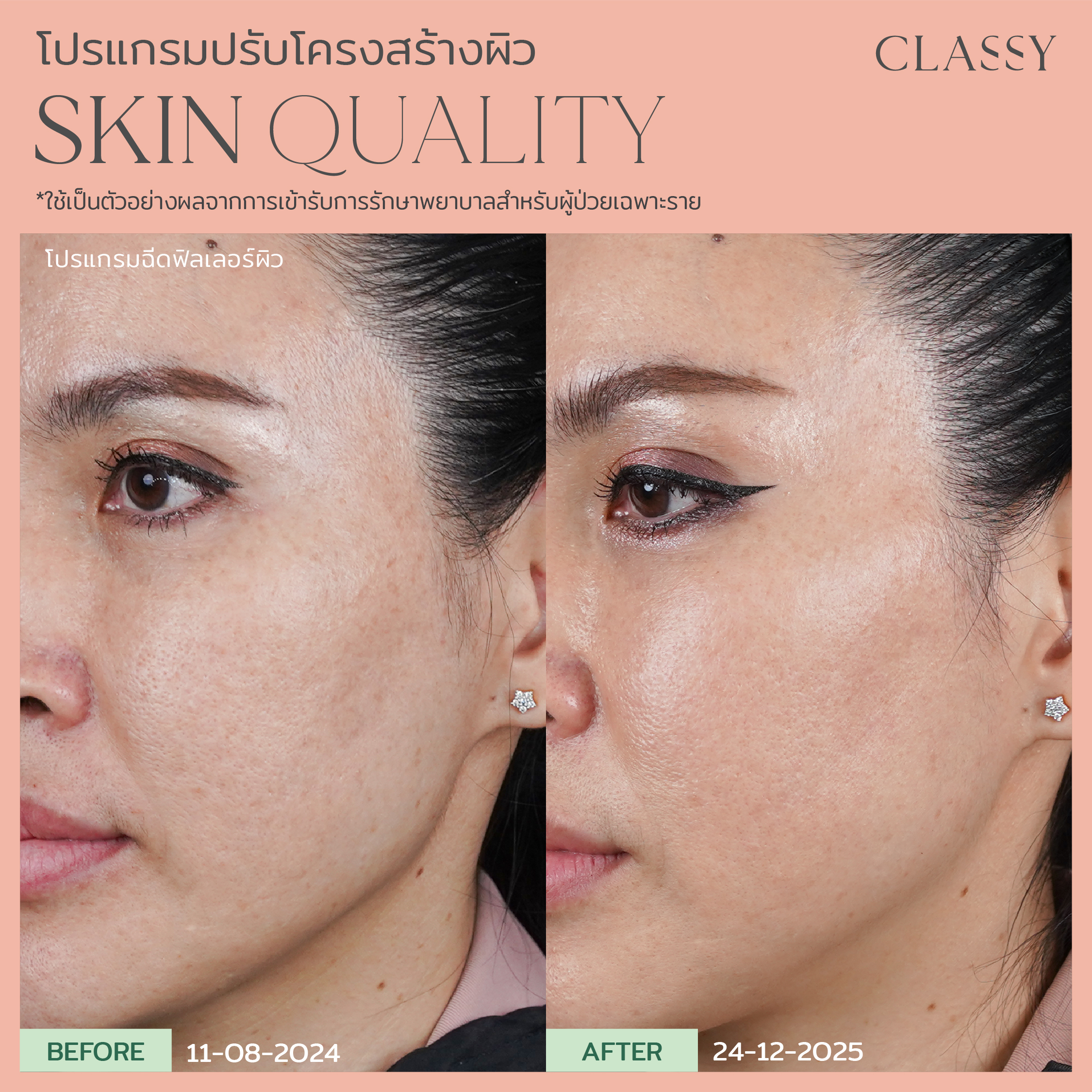 BA SKIN QUALITY-03_3