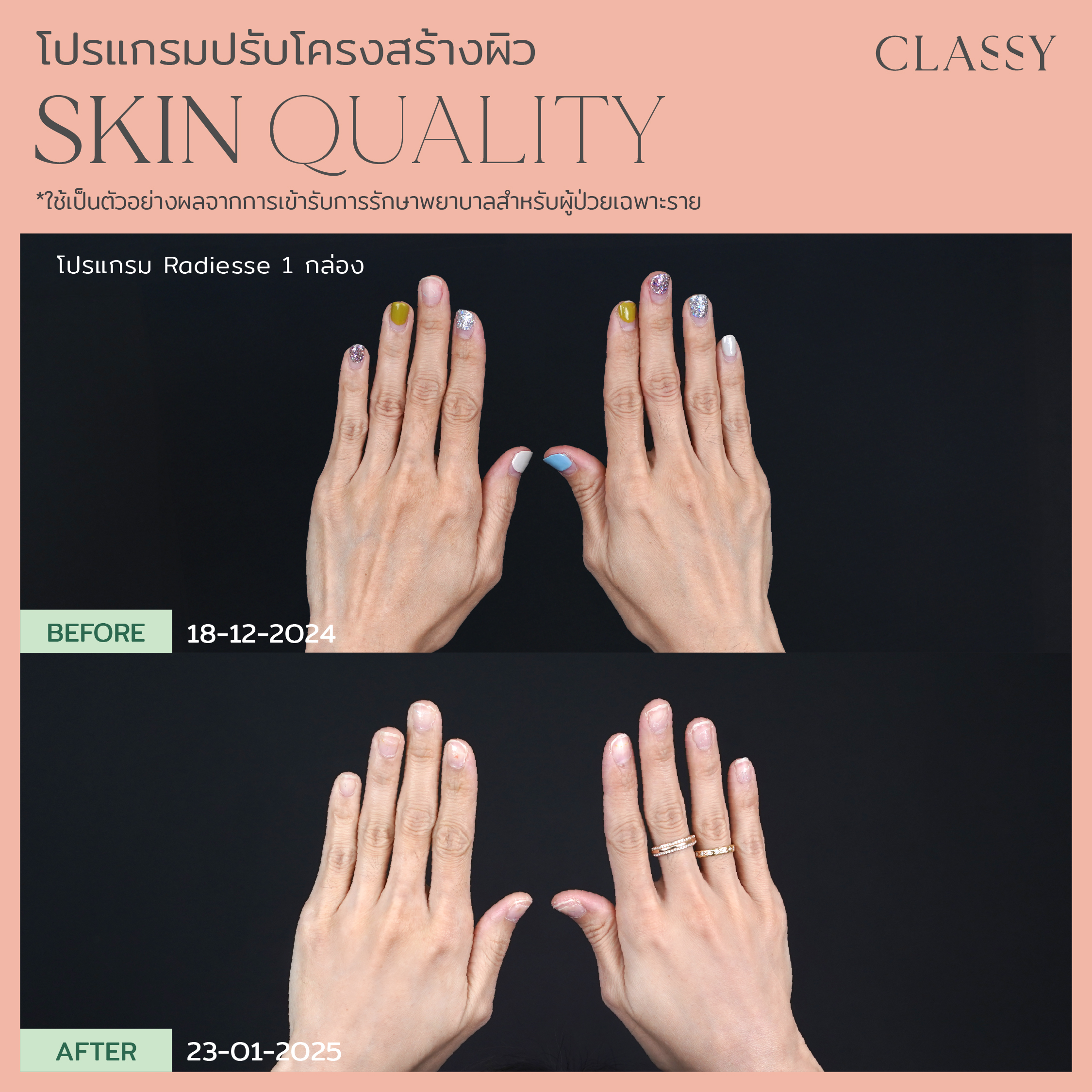 BA SKIN QUALITY-13