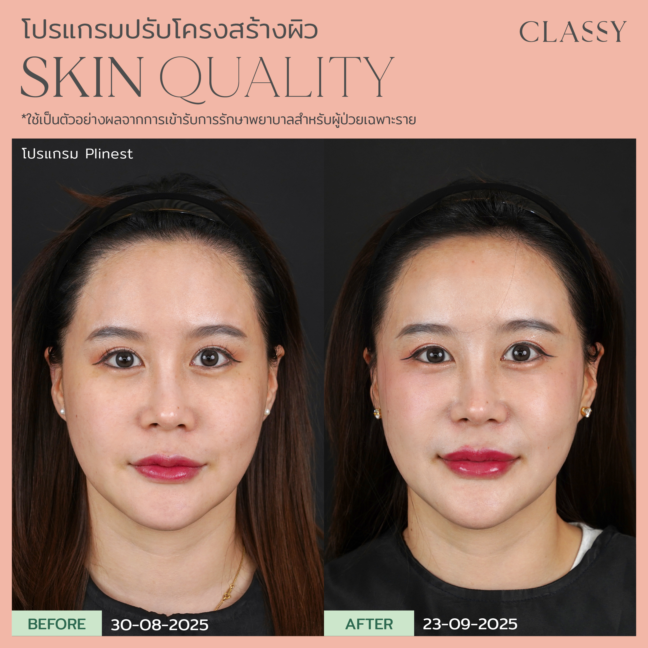 BA SKIN QUALITY-13