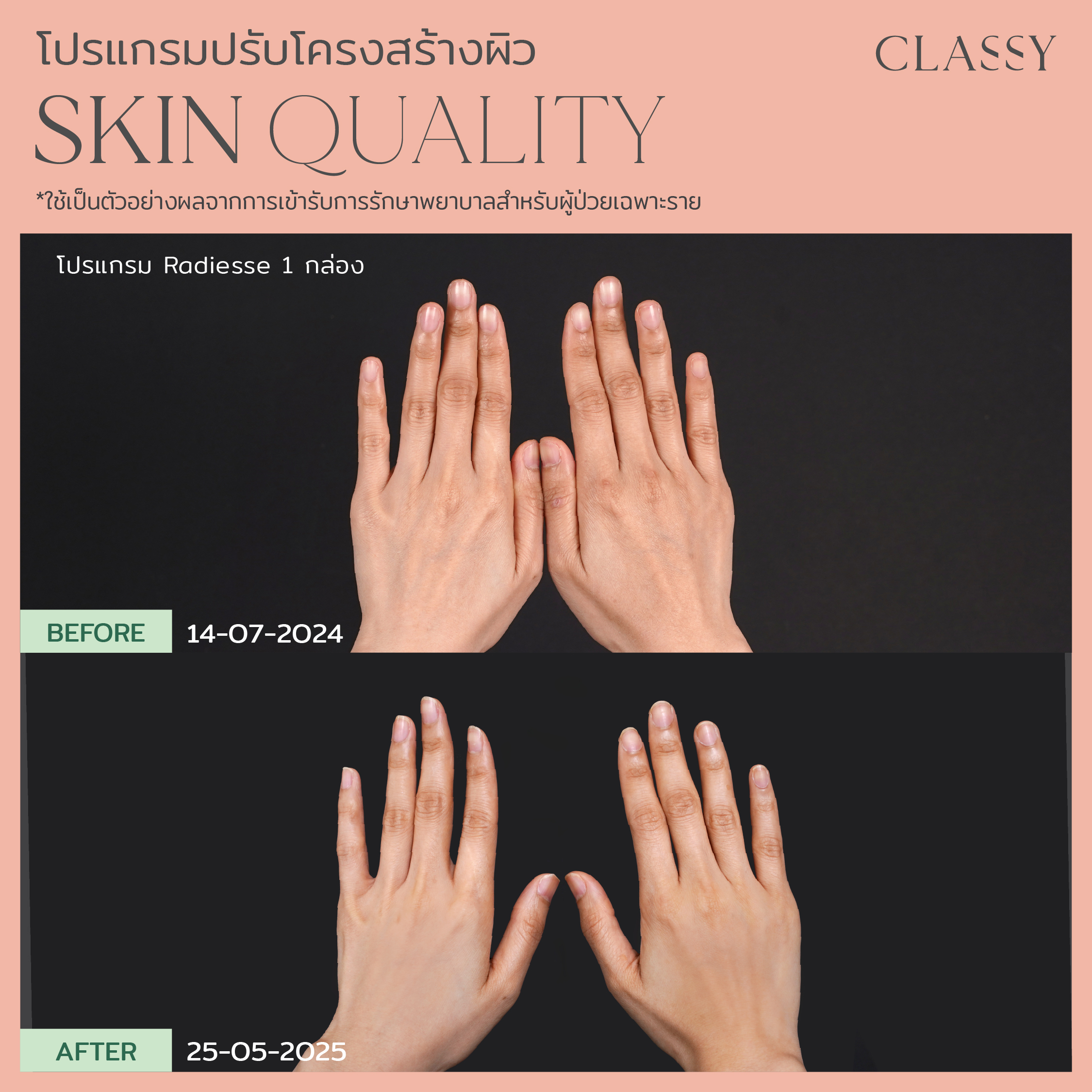 BA SKIN QUALITY-14